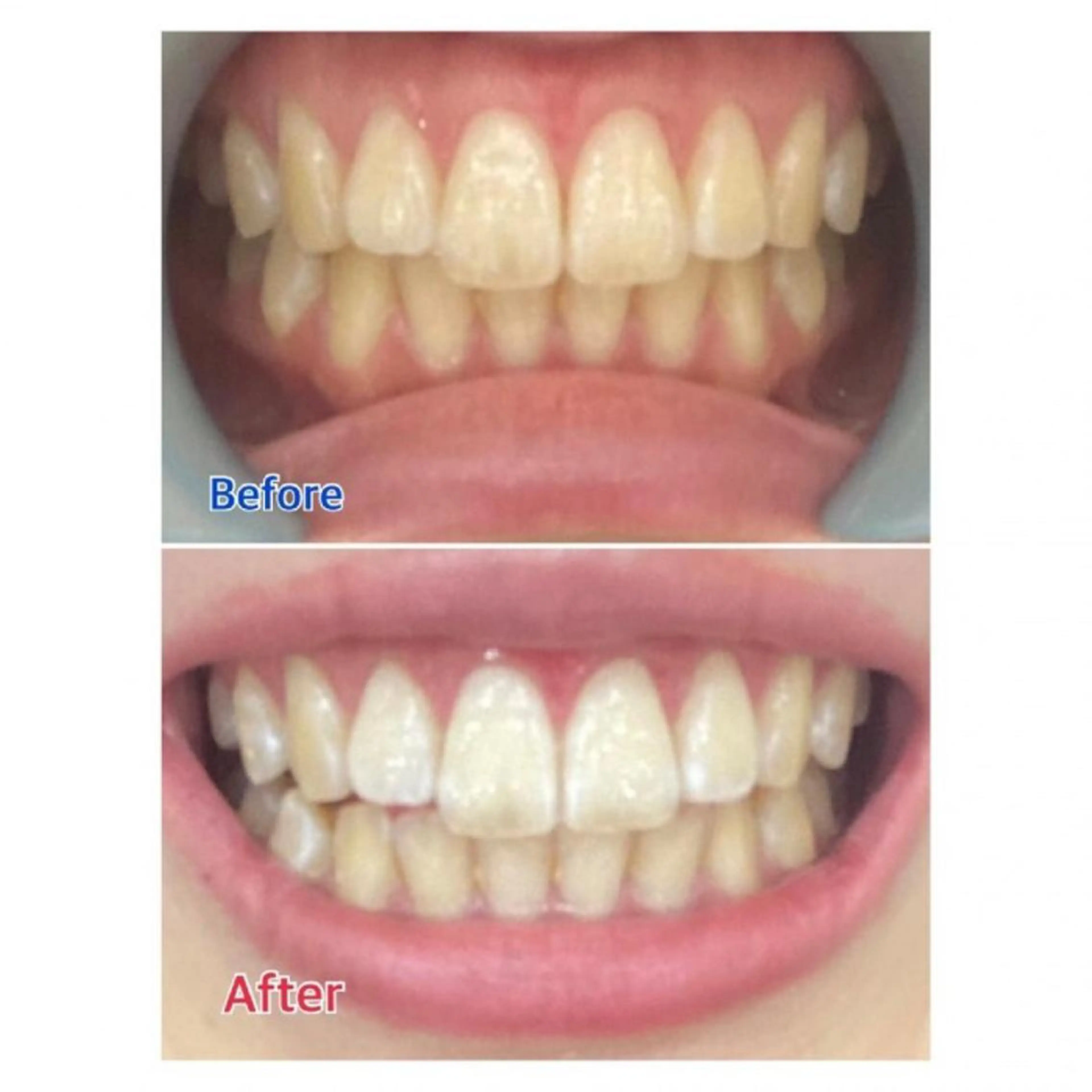 Ｍ渋谷 ホワイトニングのエステ・リラクイメージ