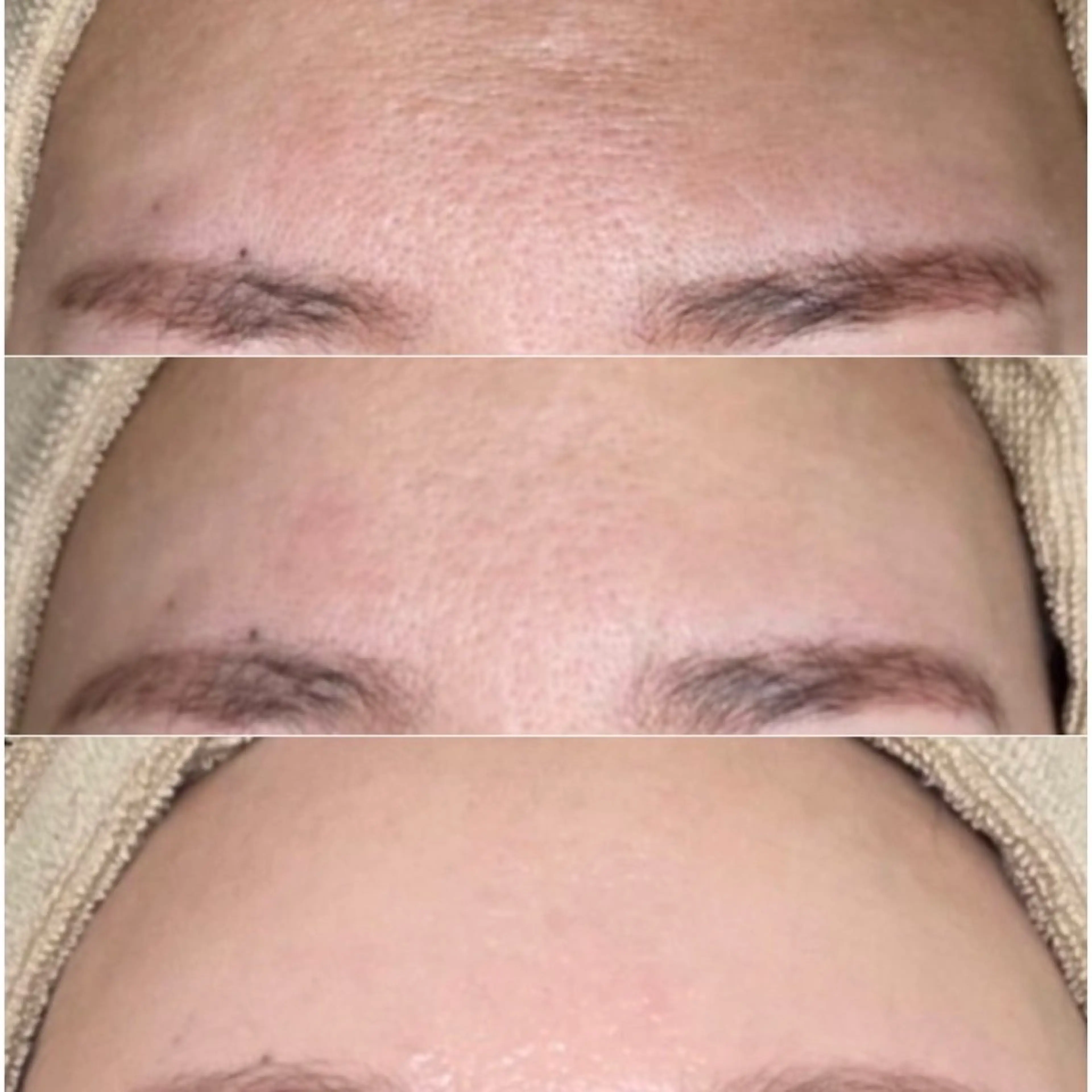 脱毛 エステサロン Mi-mi.iのエステ・リラクイメージ