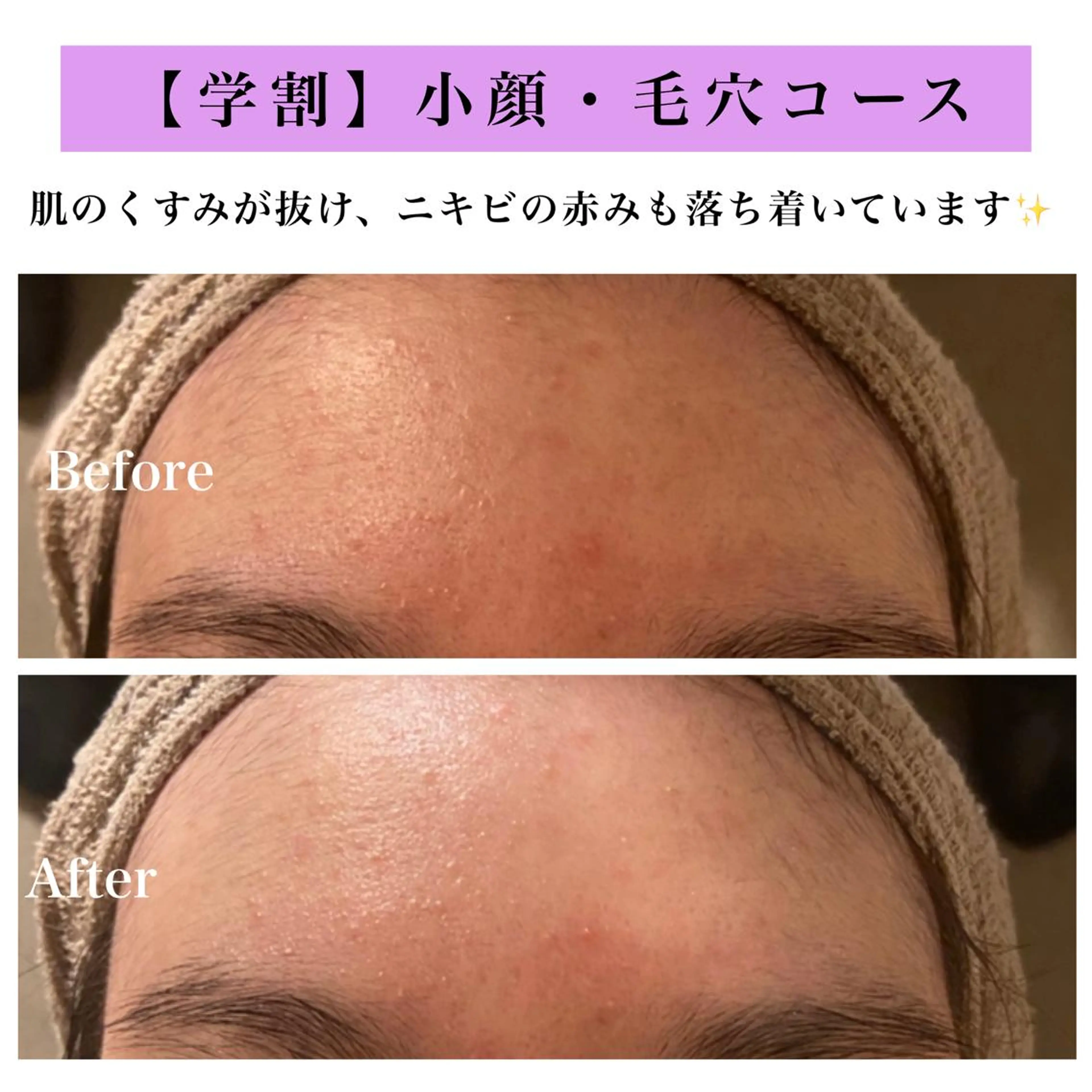 Bellesthe （ベルエステ）のエステ・リラクイメージ