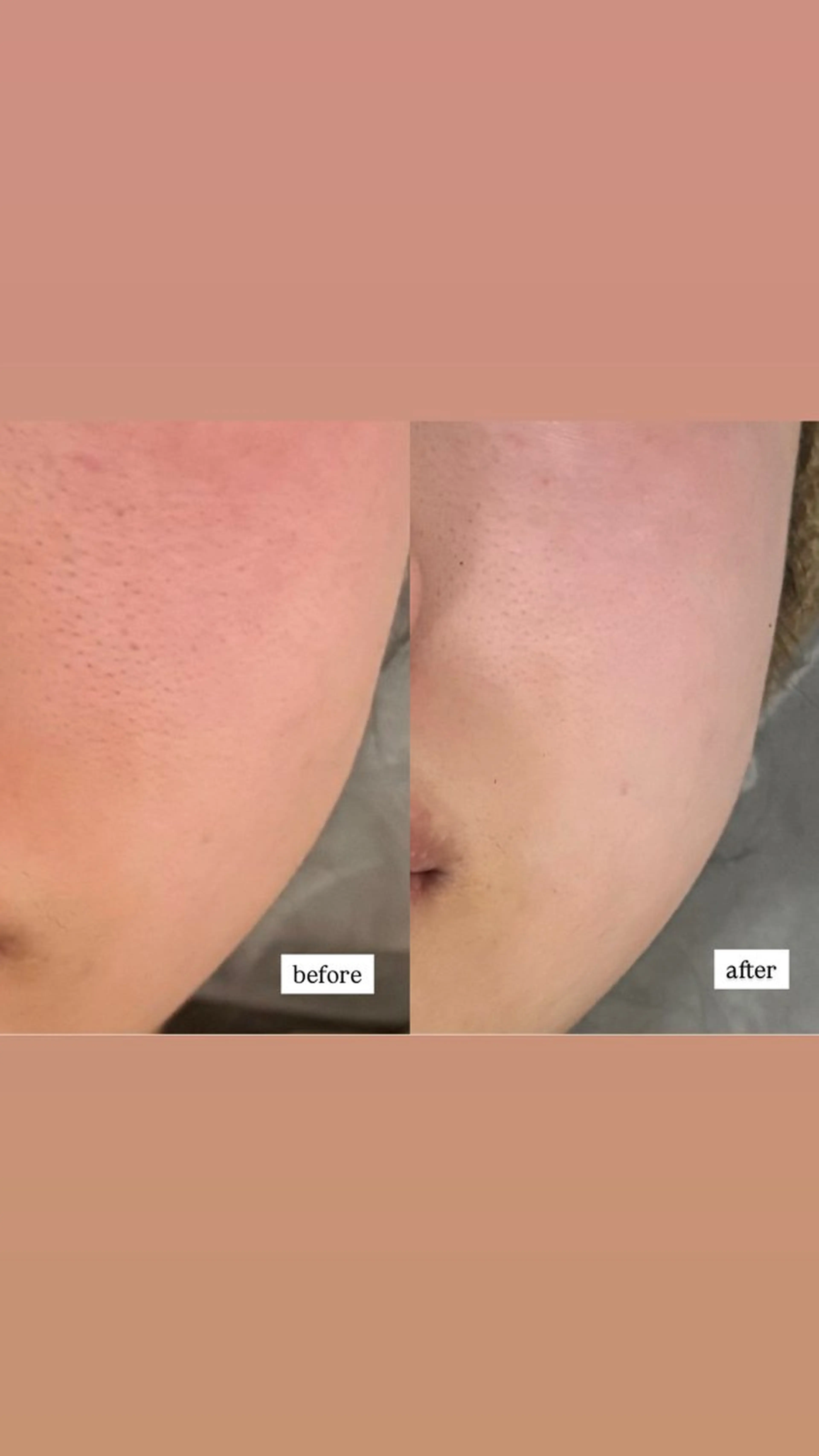 haneul ‹ハヌル›のエステ・リラクイメージ