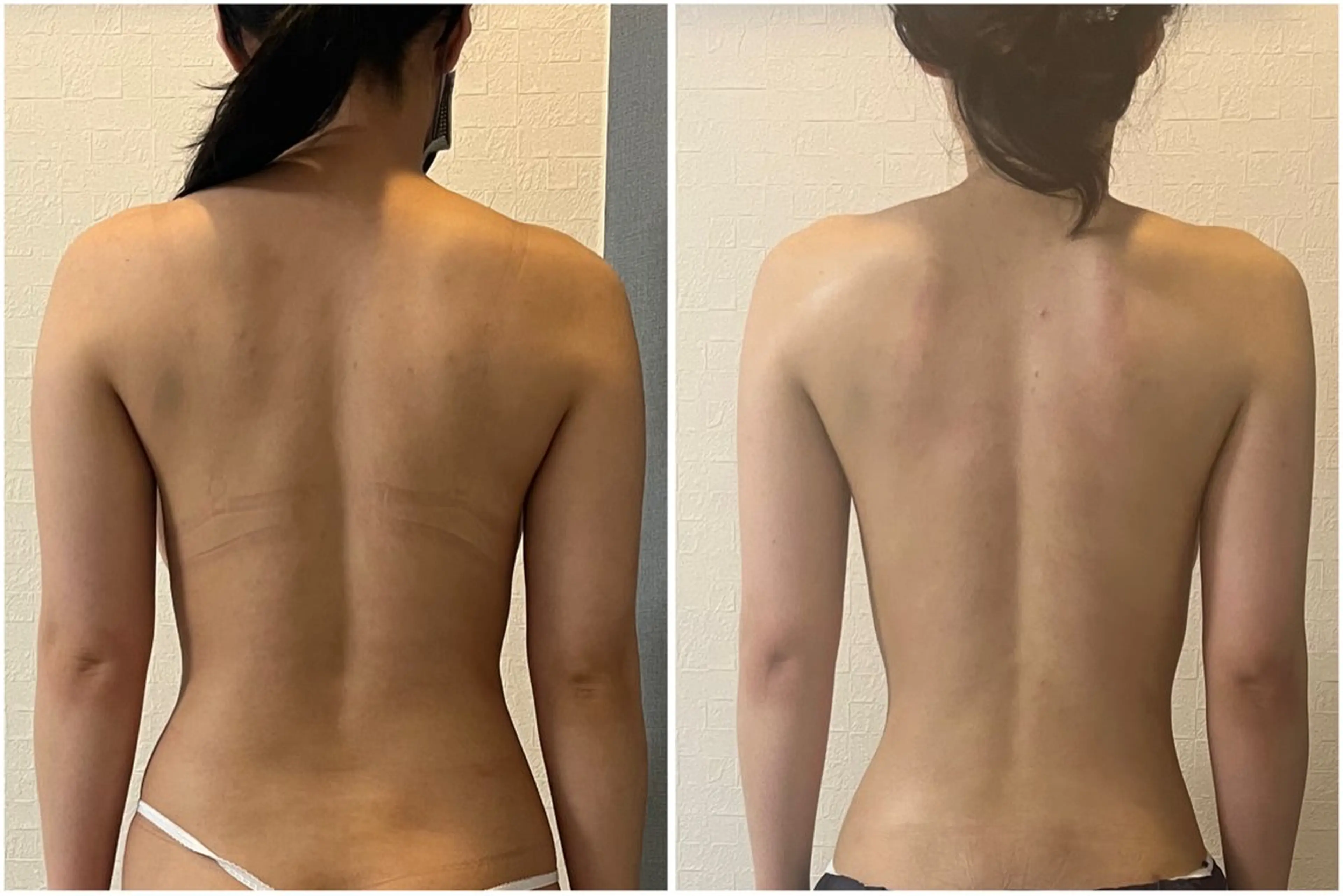 湘南エステサロン moaのエステ・リラクイメージ