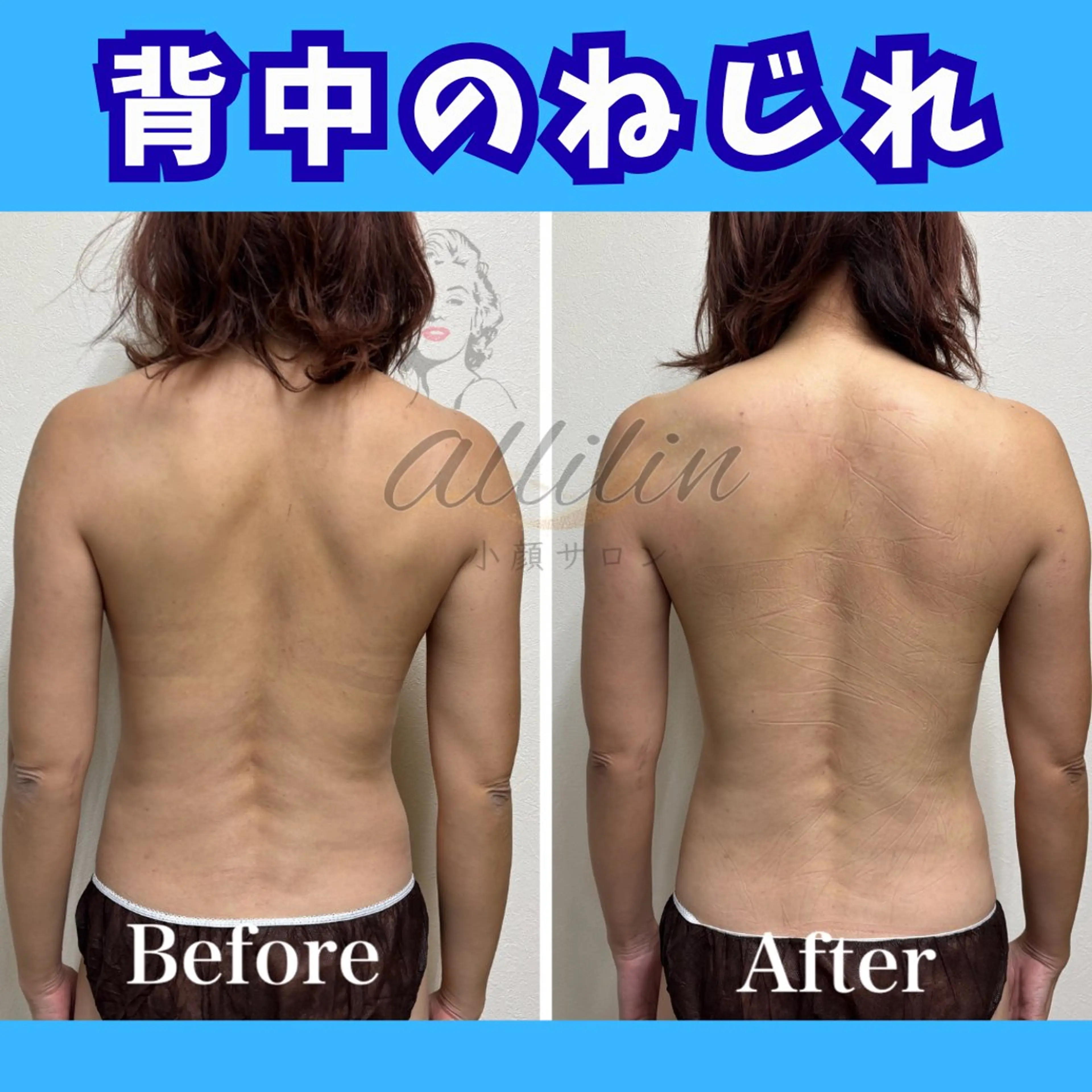 💎小顔ｻﾛﾝ アリリン銀座💎のエステ・リラクイメージ