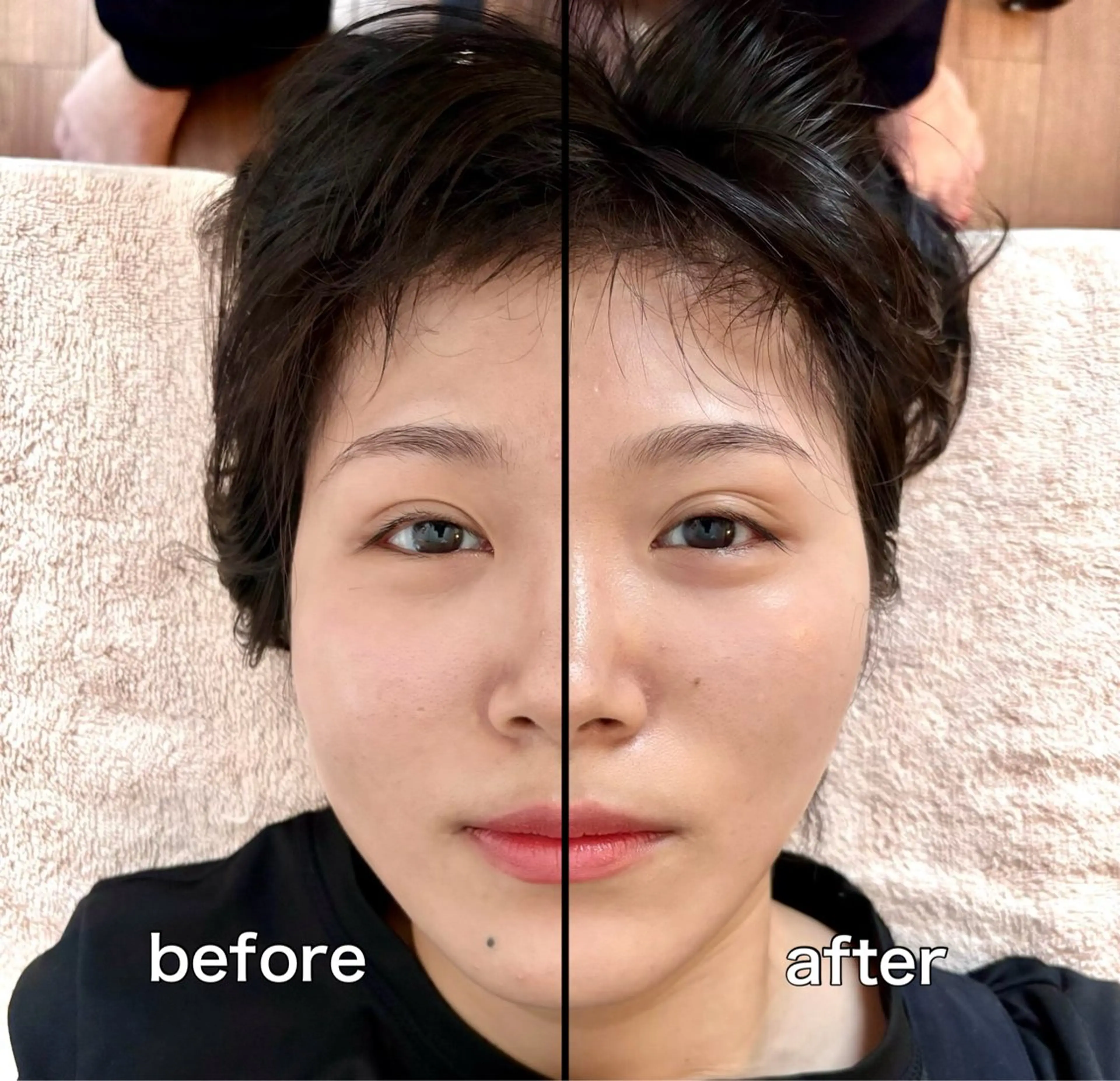 小顔整顔✨1ヶ月通い放題✨(上限あり)の写真