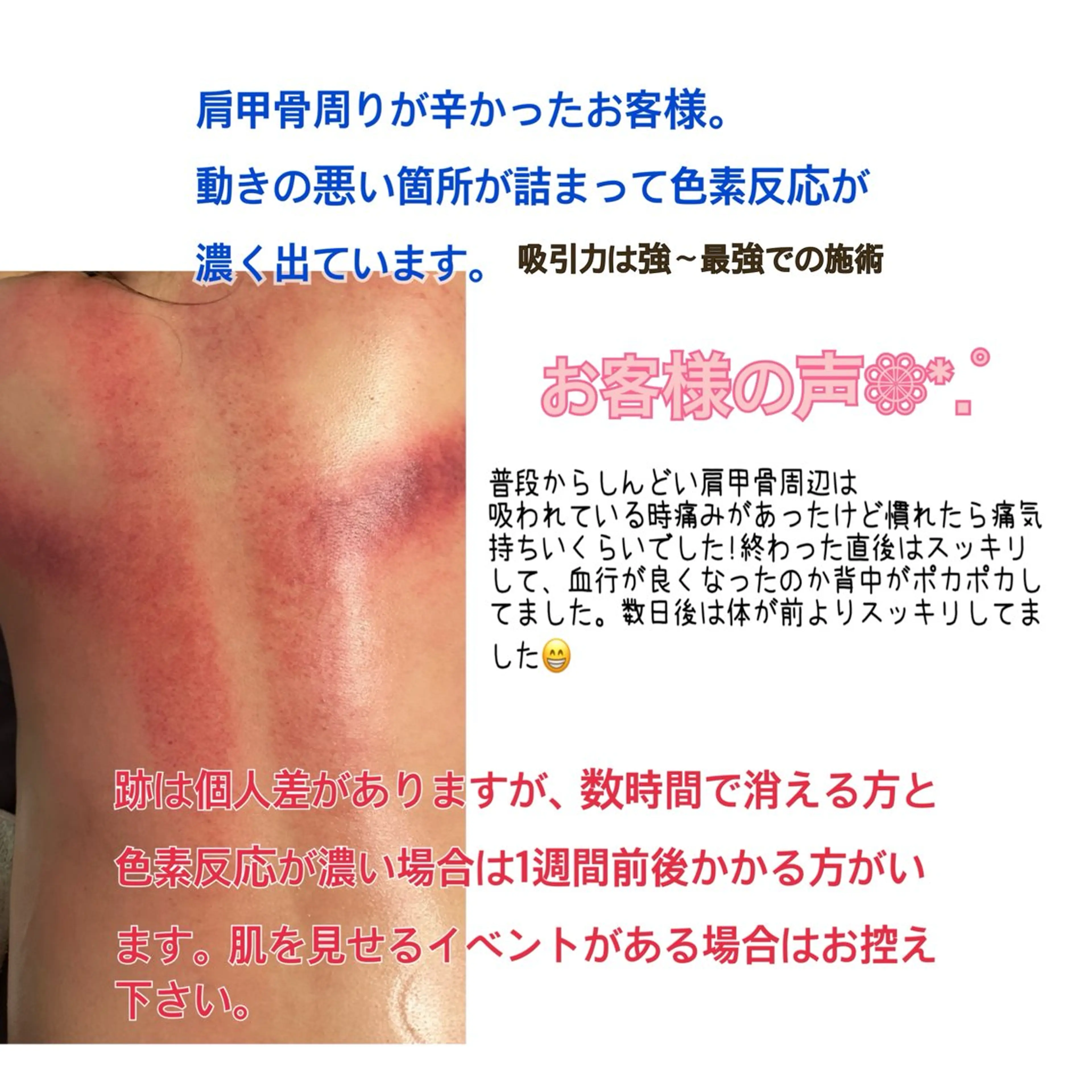 エステ リラク YURUMARU 河ノ瀬店のエステ・リラクイメージ