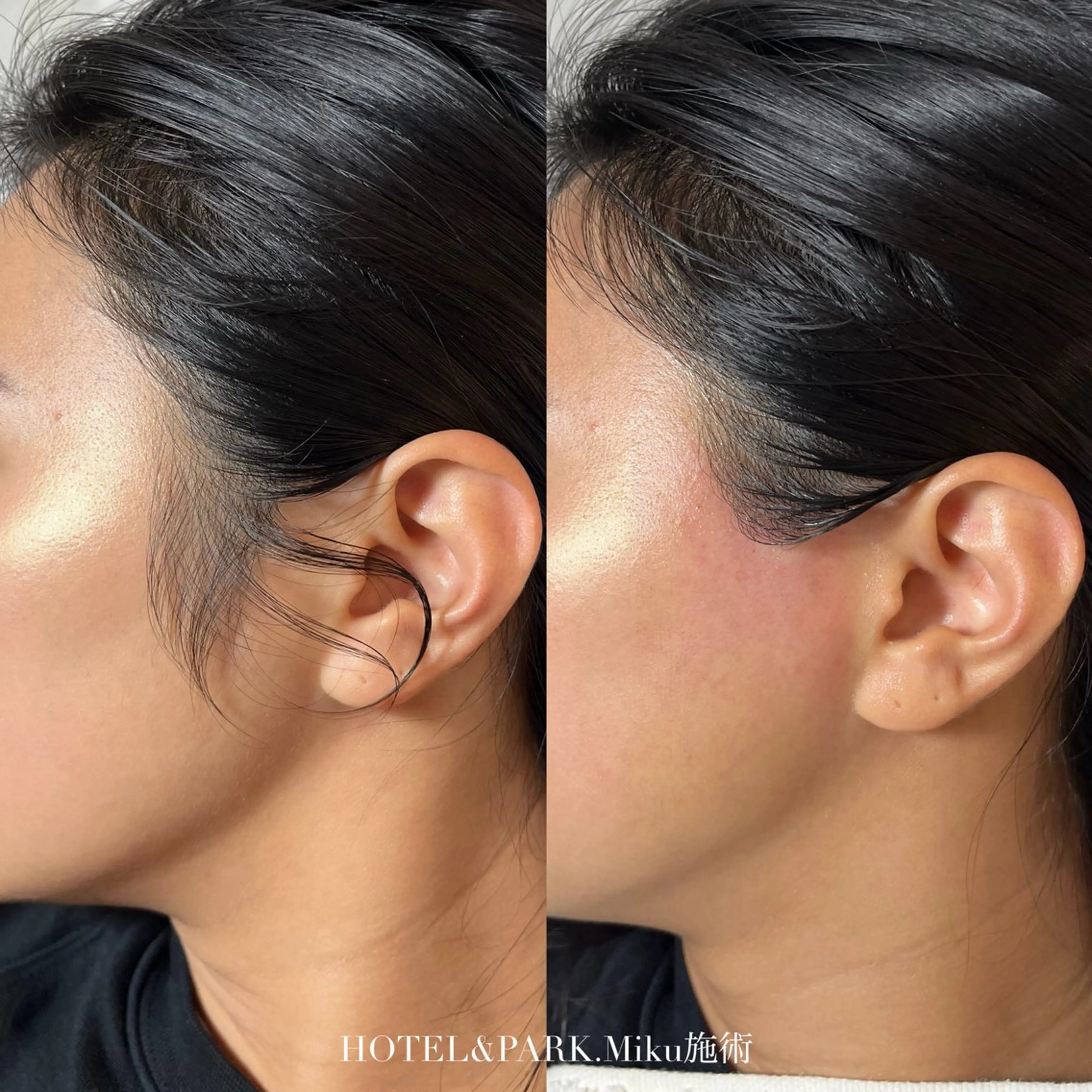 脱毛 HOTEL&PARK Mikuワックス脱毛のエステ・リラクイメージ