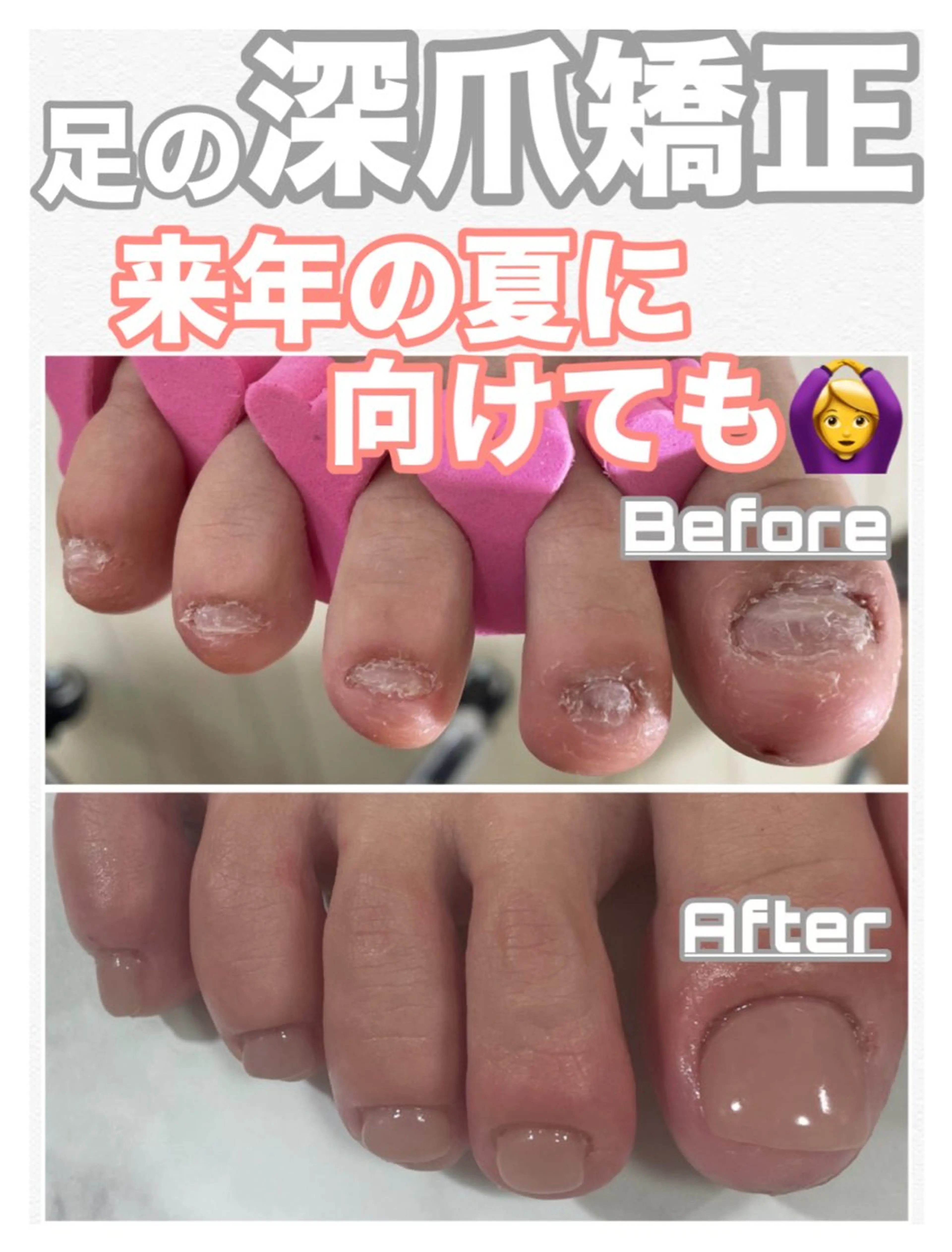 ネイル nail salon petillantのネイルデザイン