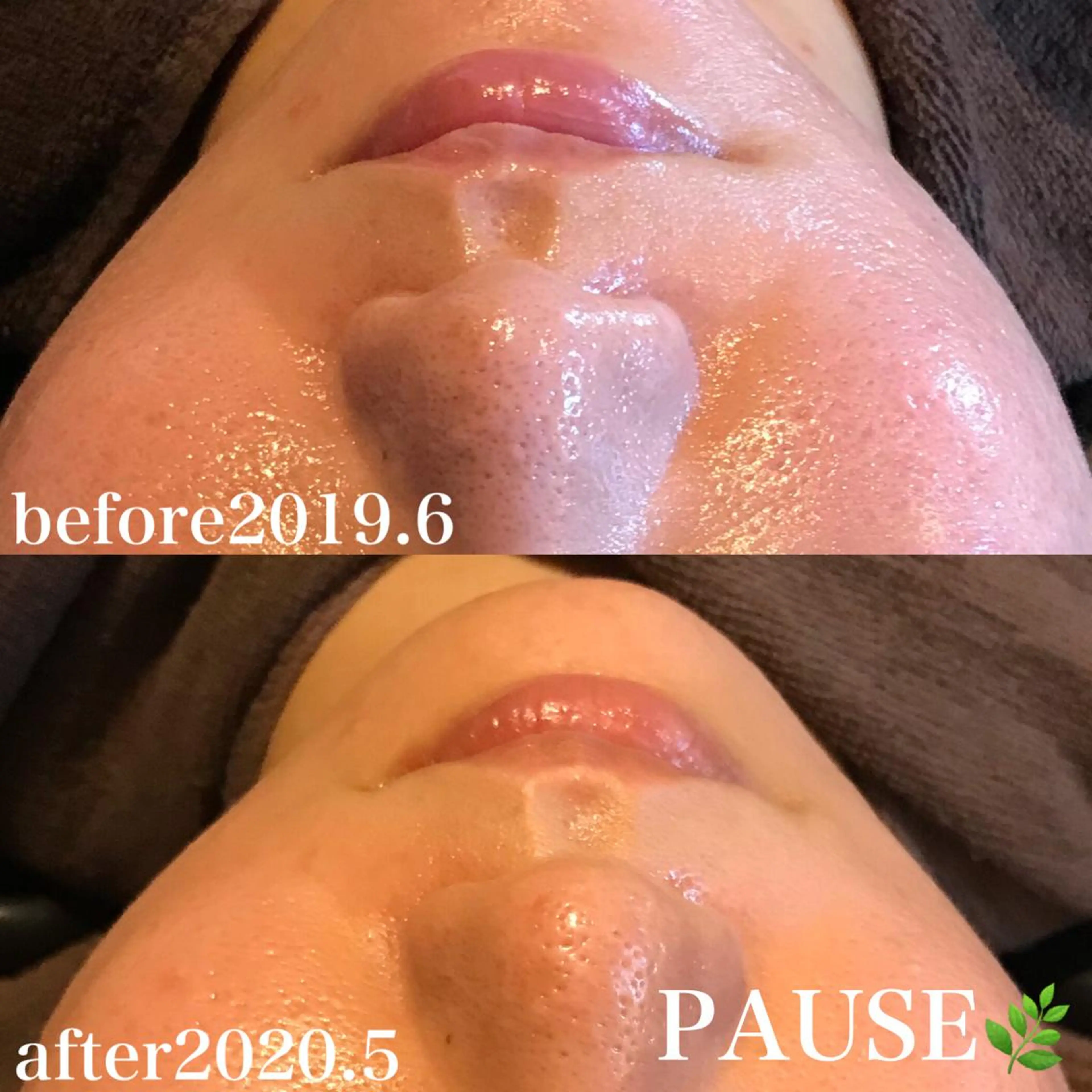 エステ 浜野 恵美のエステ・リラクイメージ