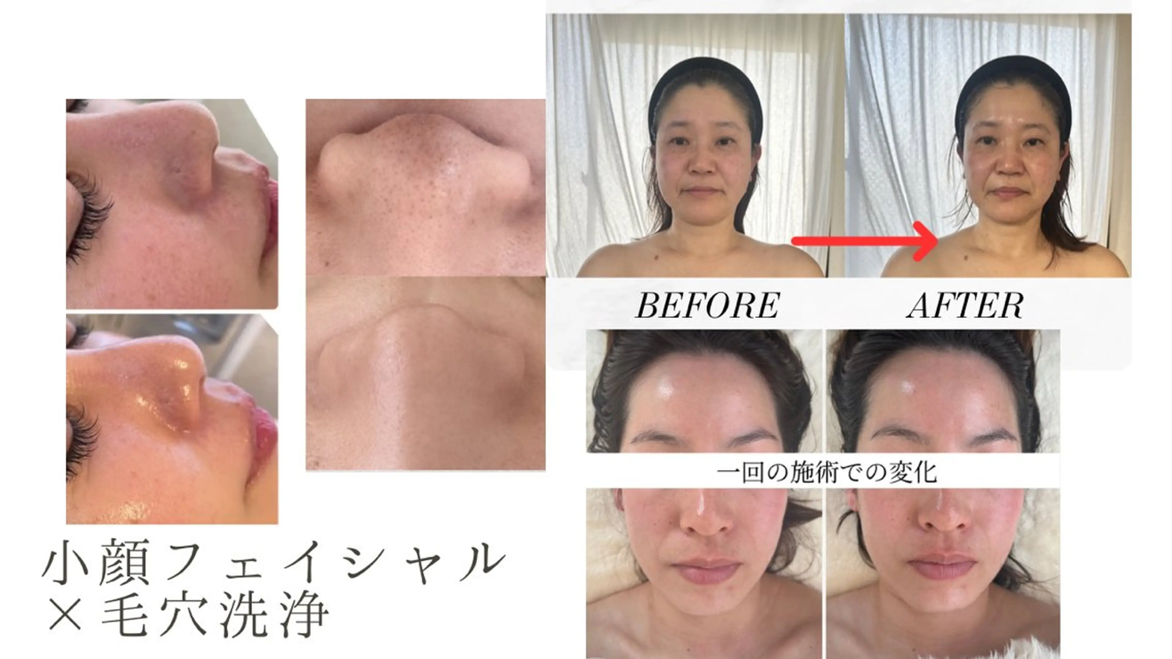 千葉小顔フェイシャル Salondesoéのエステ・リラクイメージ