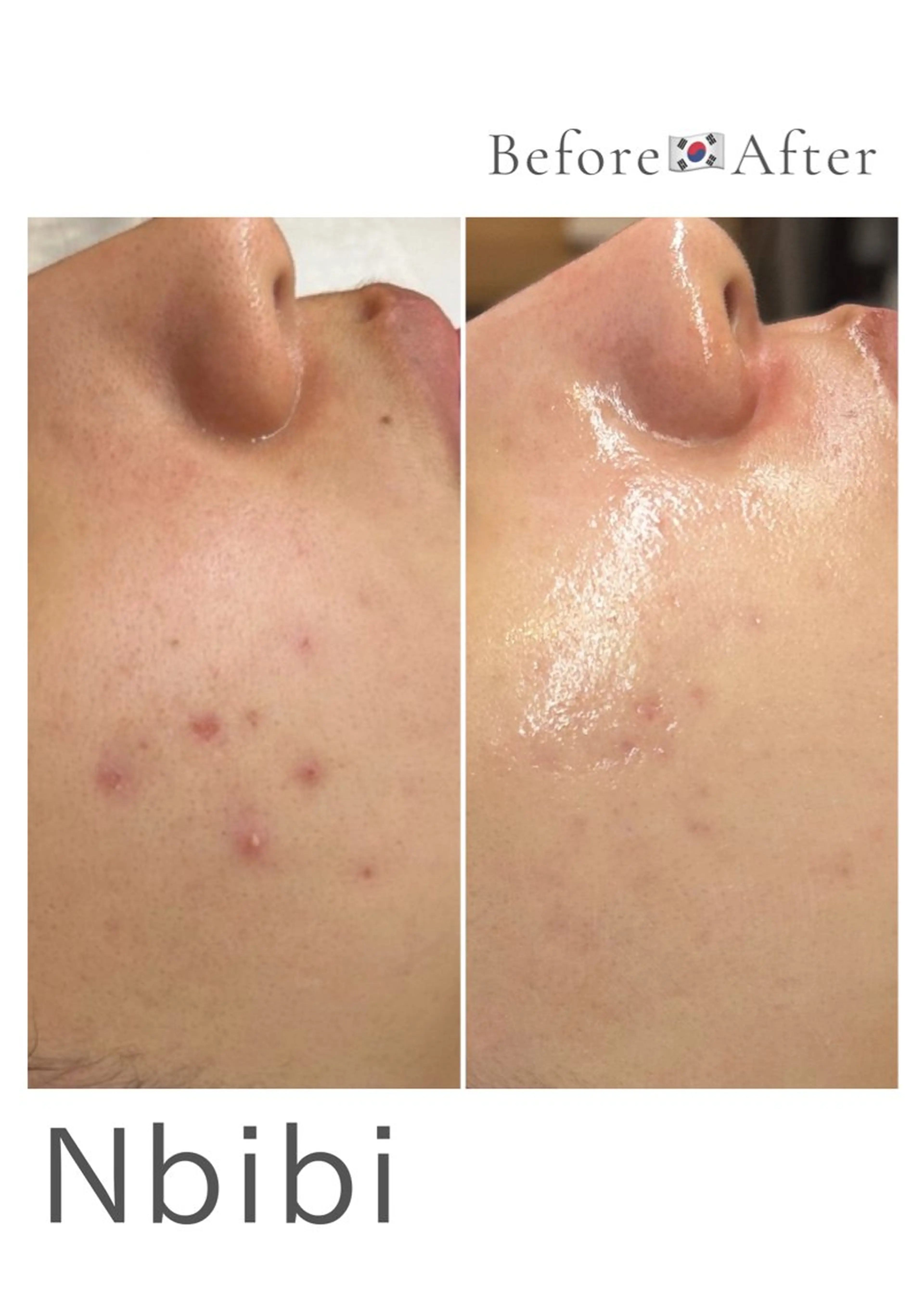 エステ 韓国🇰🇷価格 サロン_Nbibiの眉毛・アイブロウイメージ