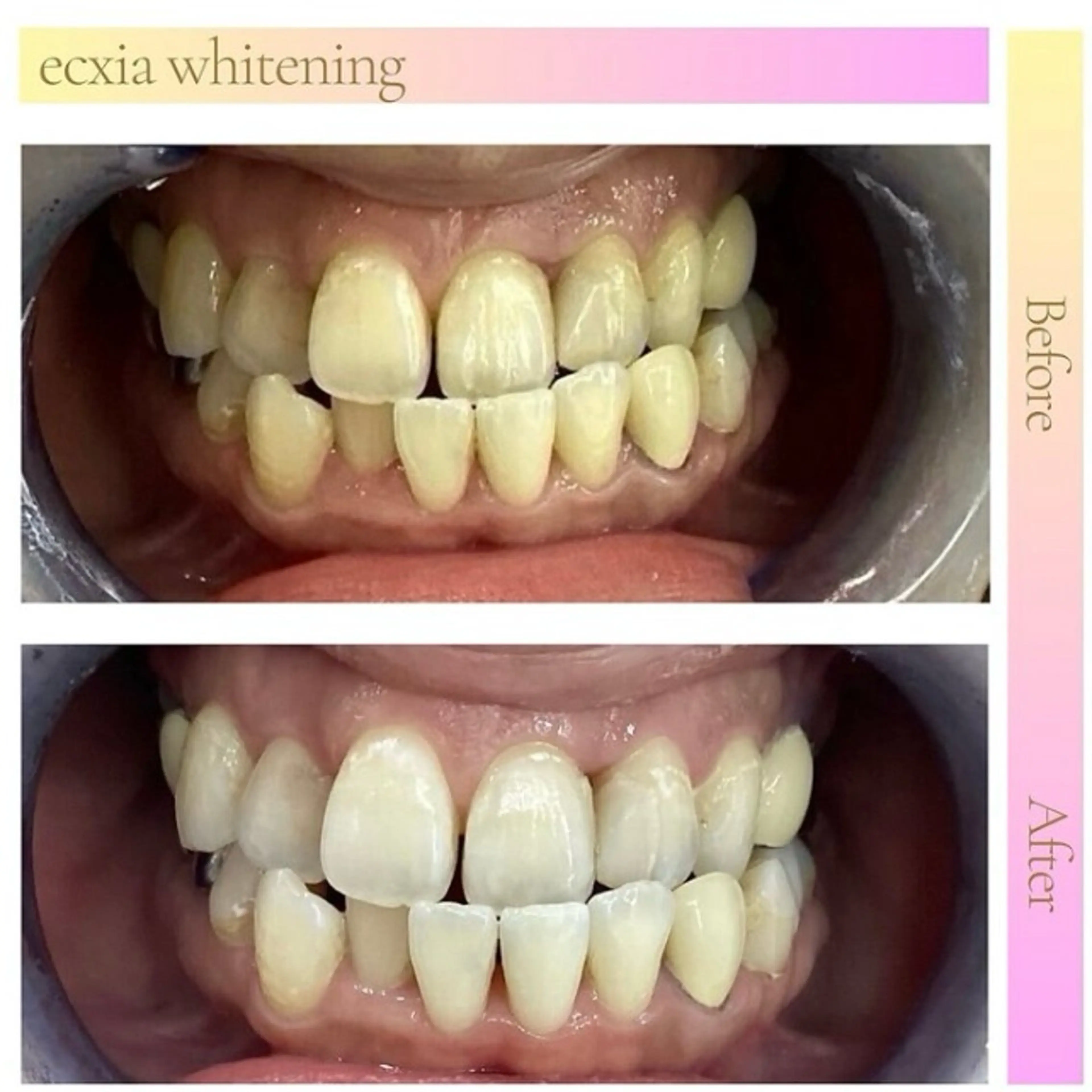 エクシアホワイト 伊勢崎店のその他イメージ