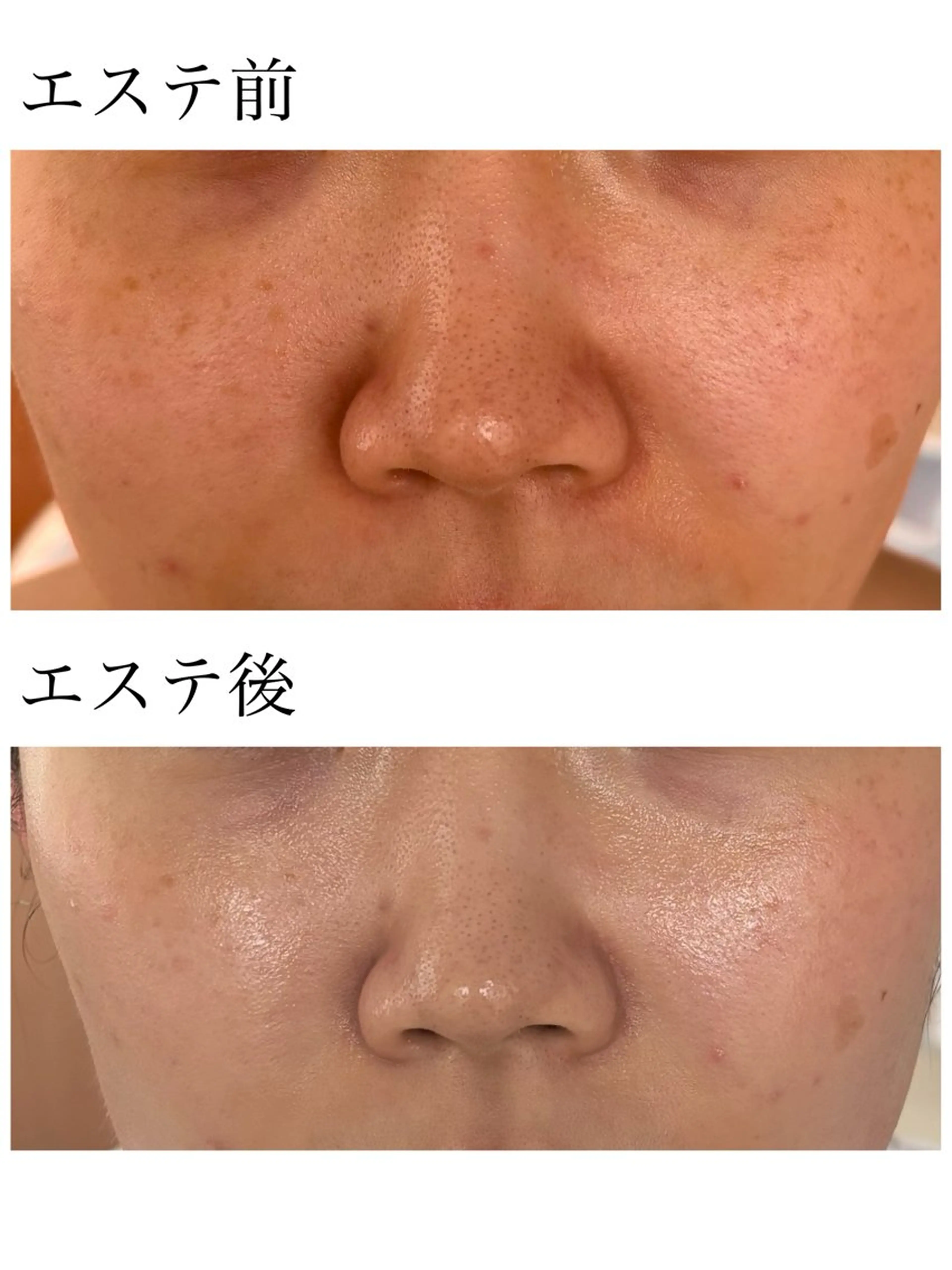 YUI🤍乾燥ゆらぎ 肌🌿即透明感✨のエステ・リラクイメージ