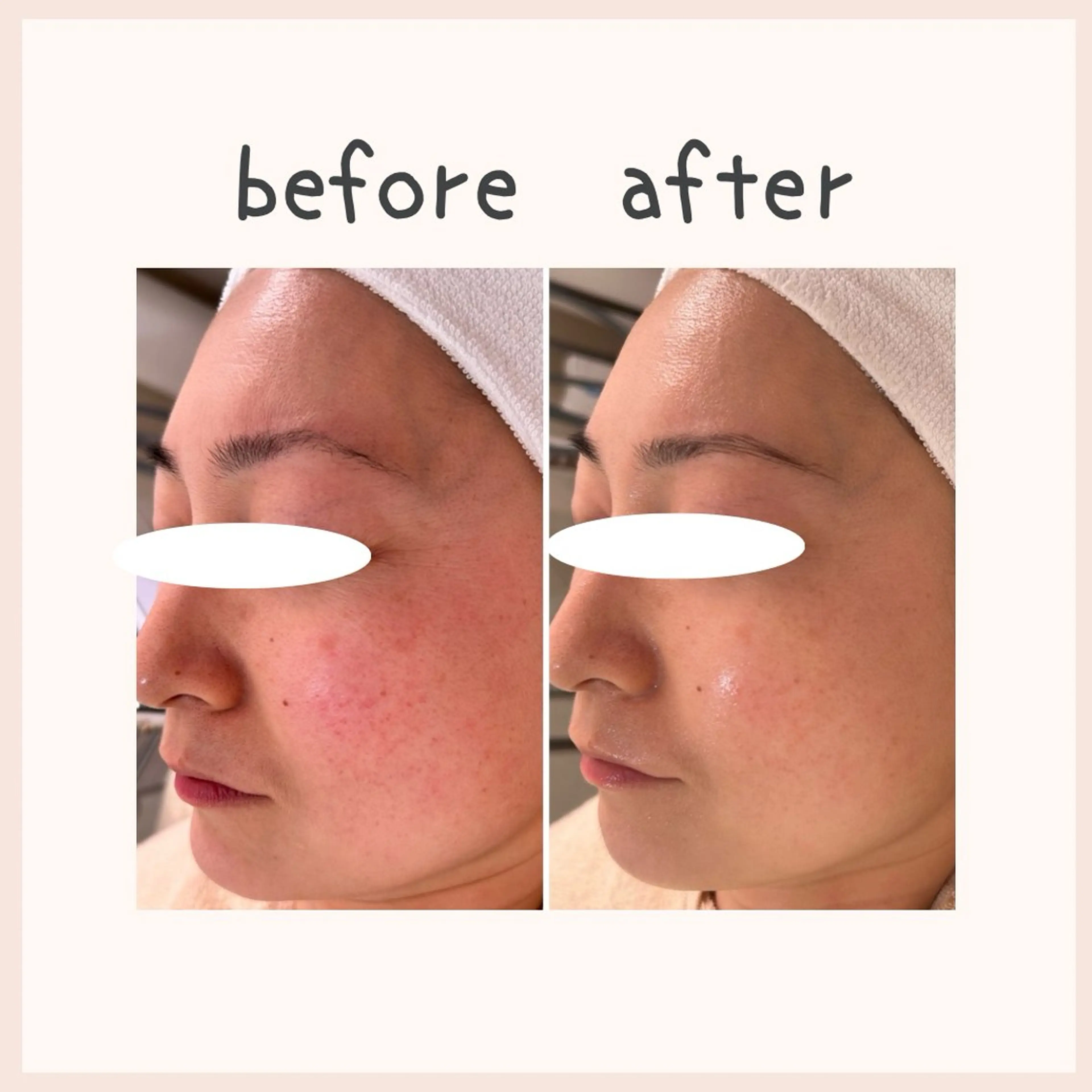 エステ 中澤 夢華のエステ・リラクイメージ