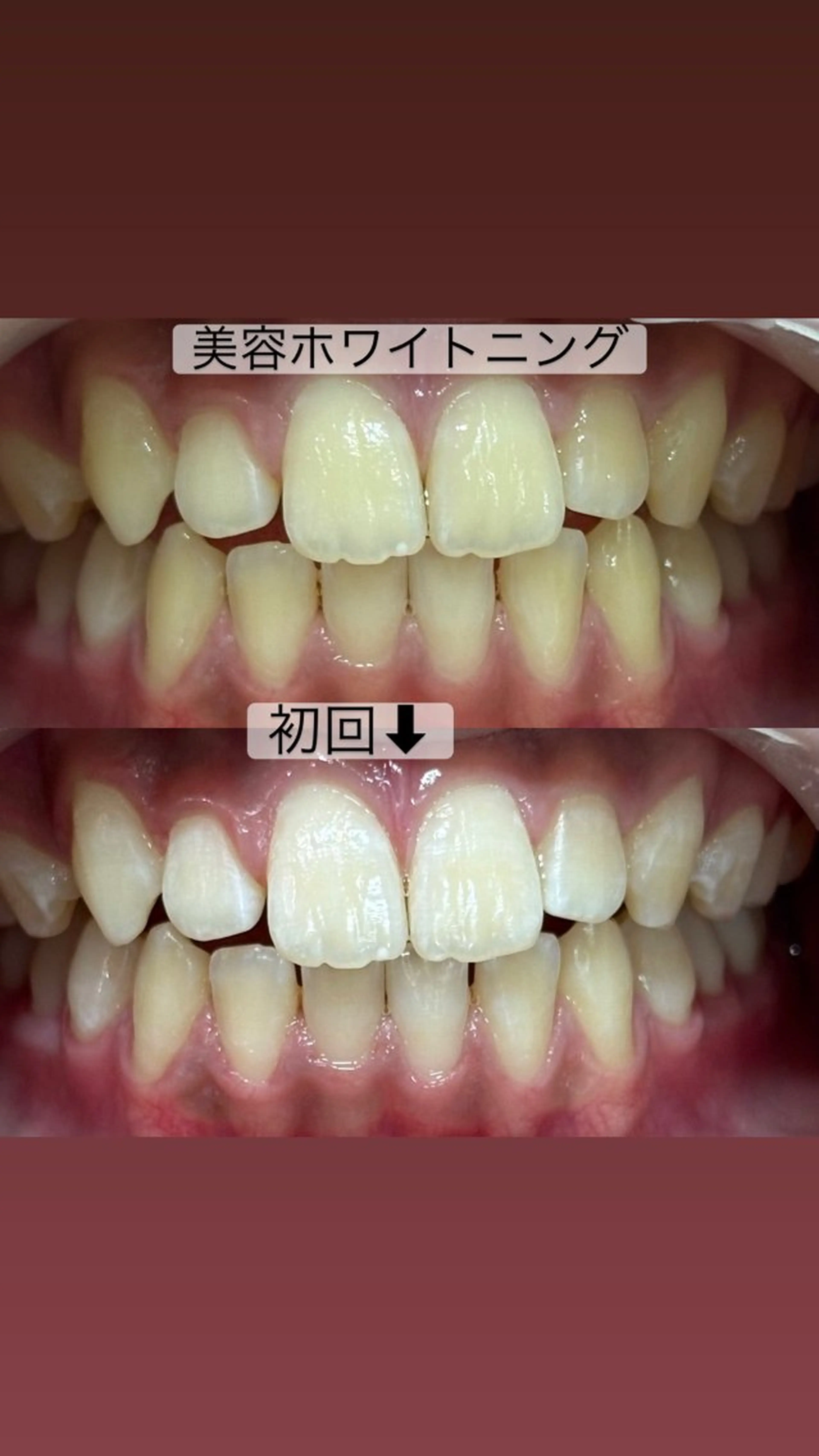 whitening salon yatto.所属・ホワイトニングサロン yatto.のその他イメージ