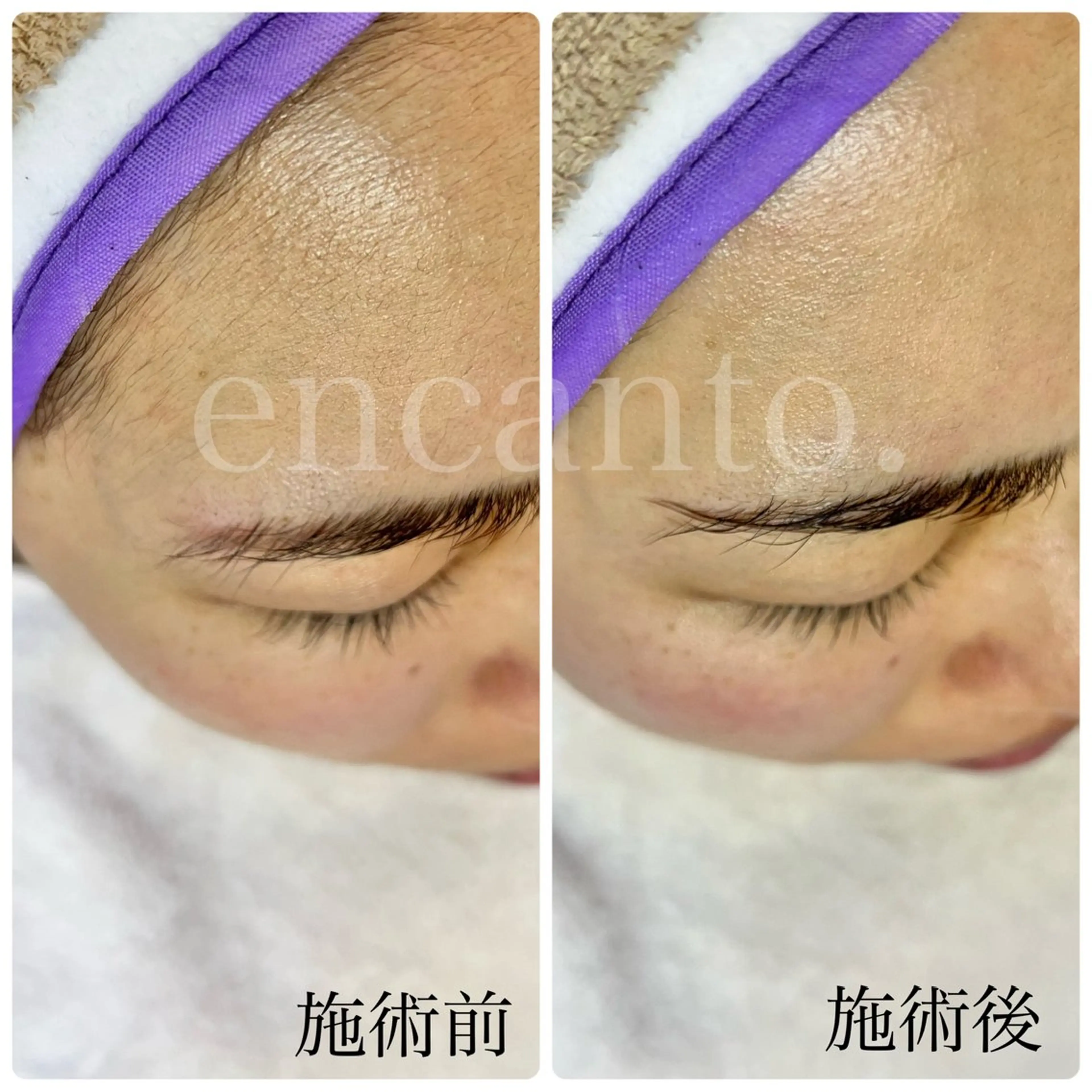 エステ 杉本 里保のその他イメージ