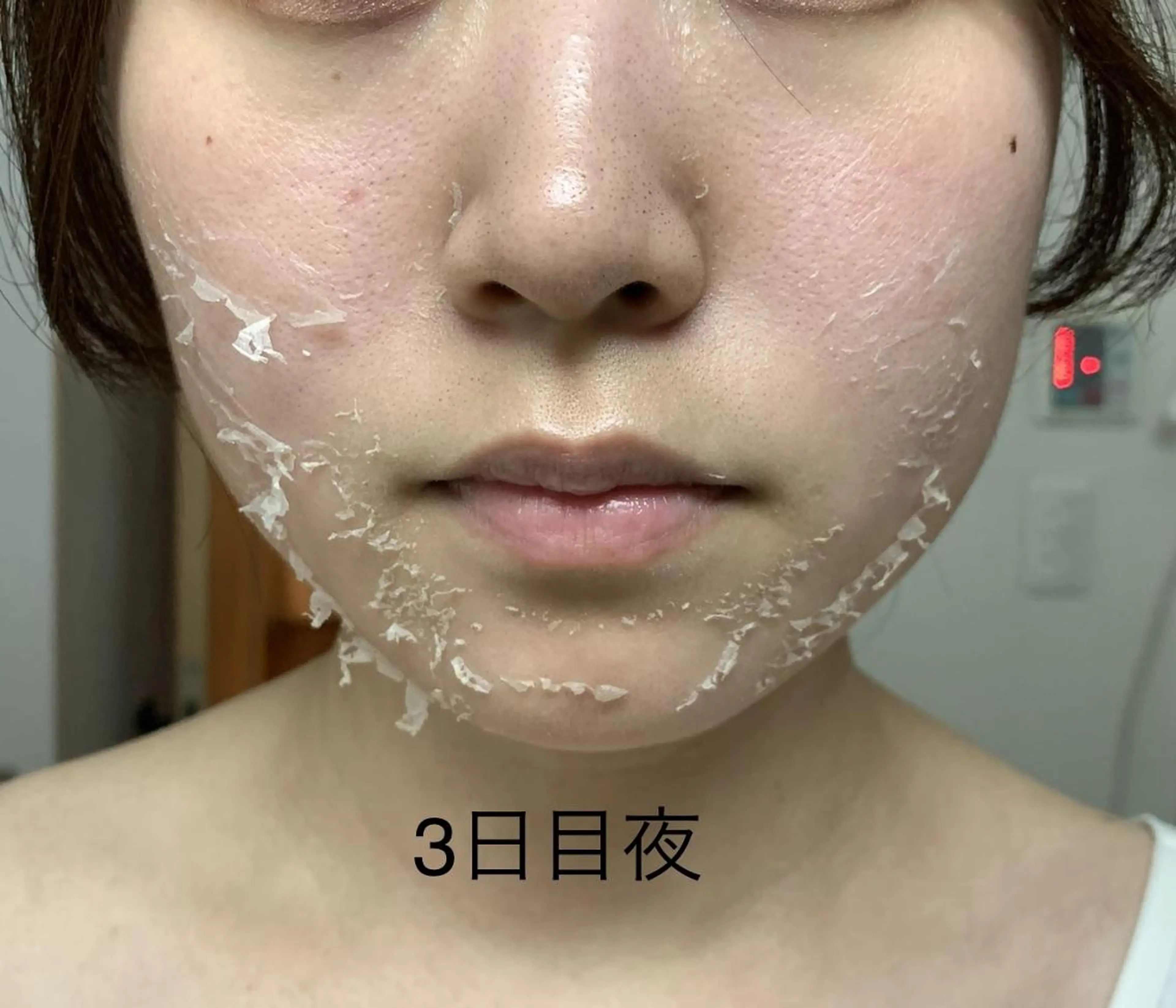 エステ リラク U24限定クーポン レイビス池袋MANAのエステ・リラクイメージ