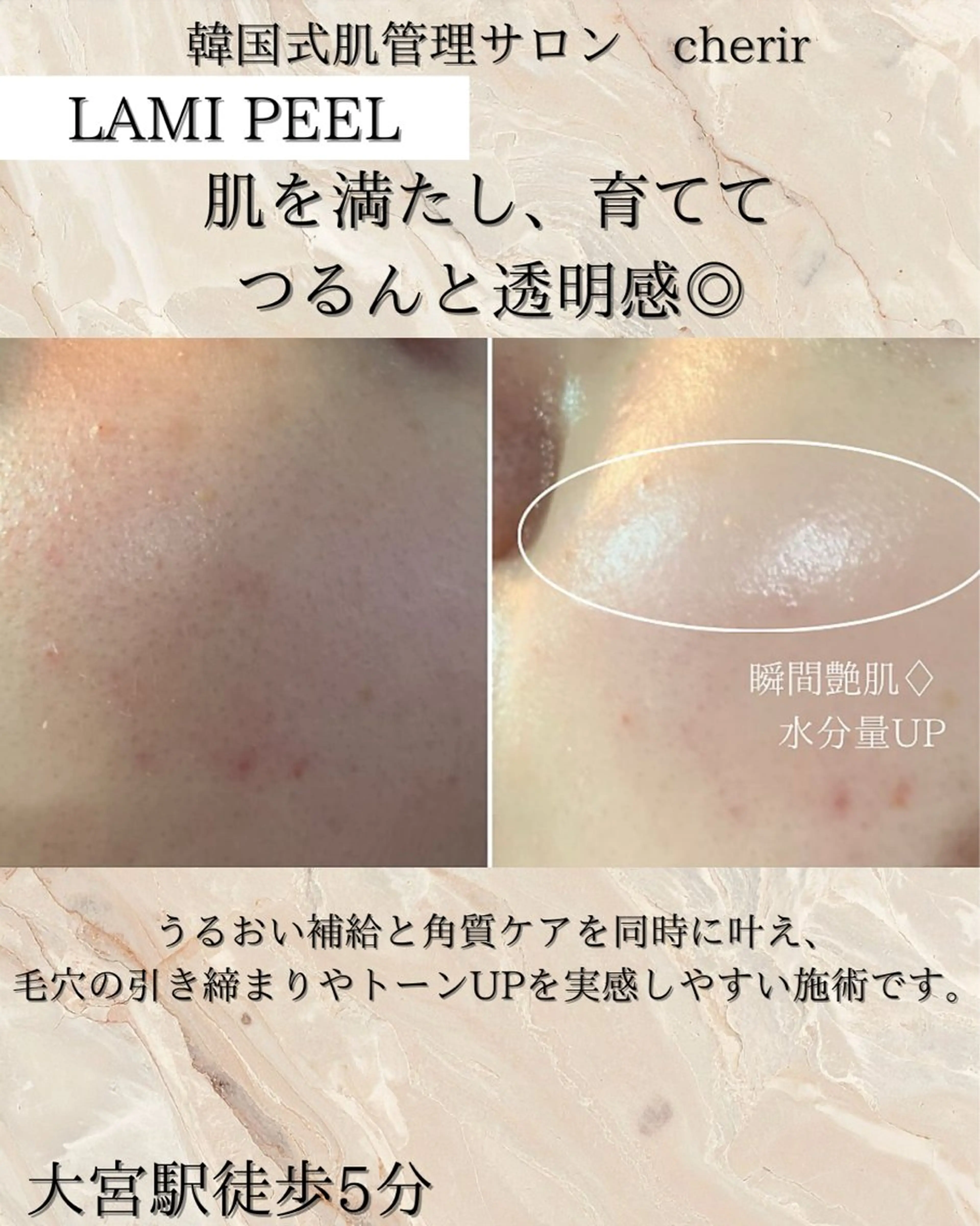 cherir 大宮のエステ・リラクイメージ