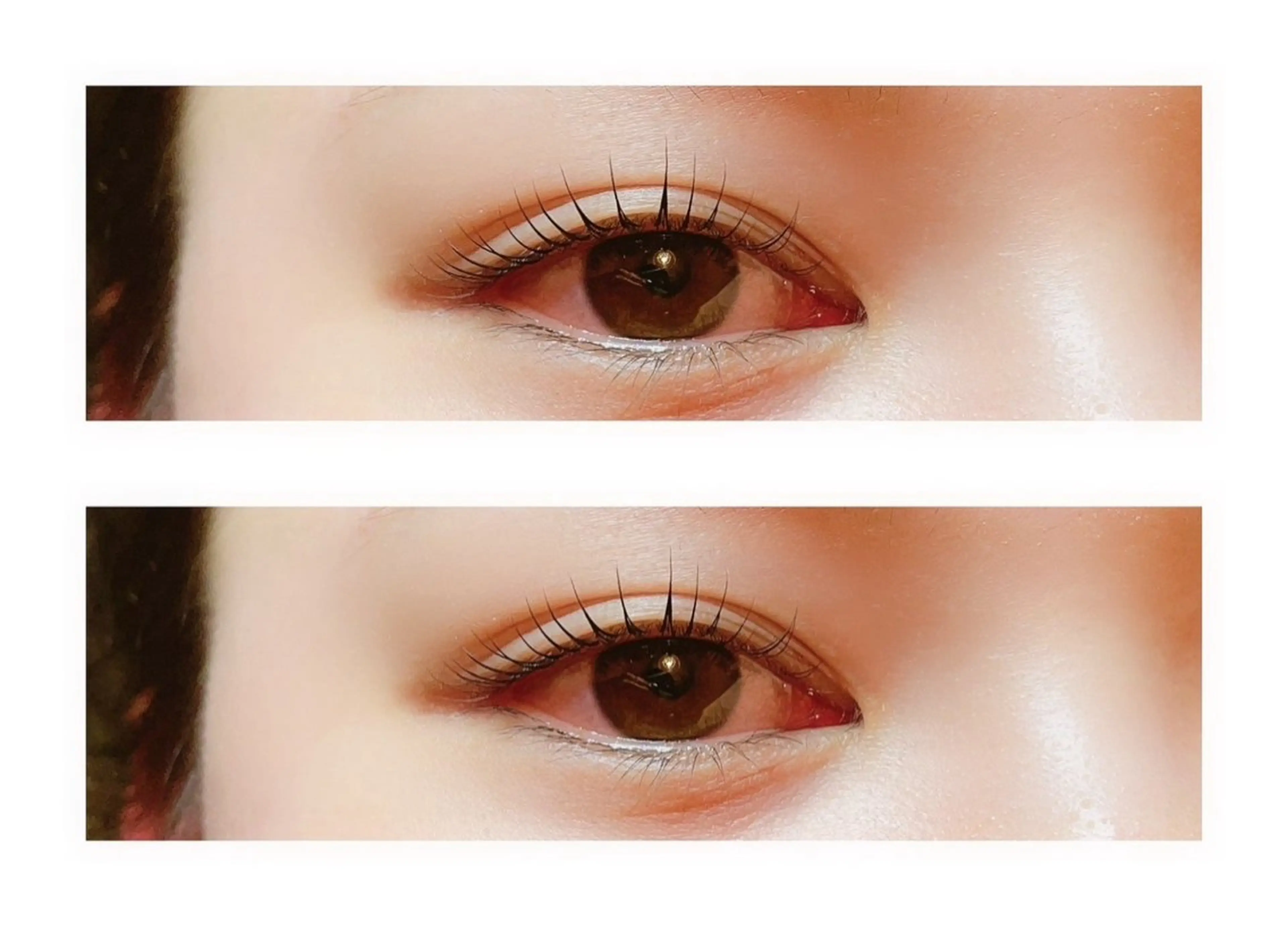 マツエク・マツパ トータルサロンRuby所属・【医療提携】脱毛 小顔ハーブピーリングのエステ・リラクイメージ