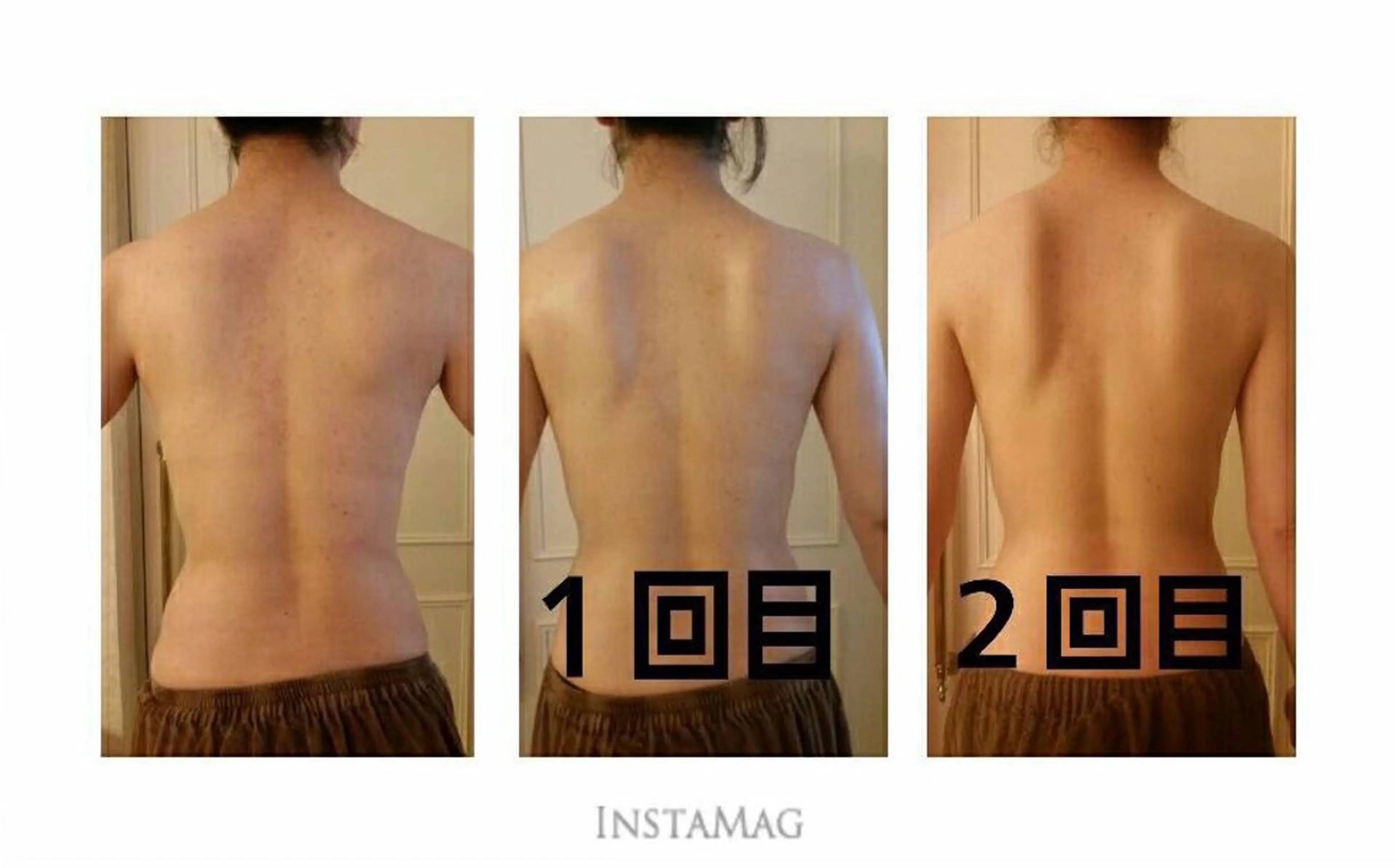 肌質改善＆脱毛 【M Mondo】のエステ・リラクイメージ