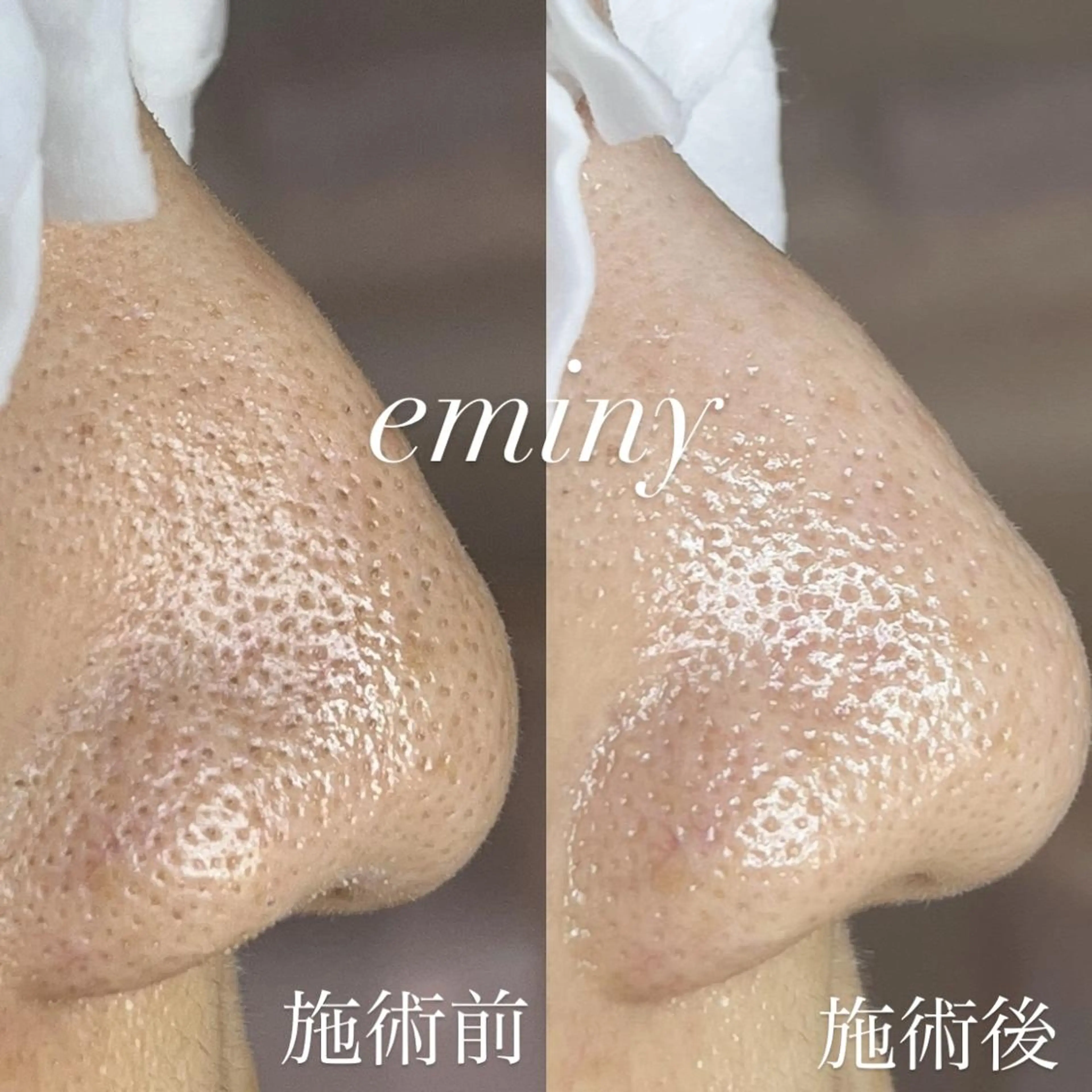 EMINY （エステティシャン）のエステ・リラクイメージ