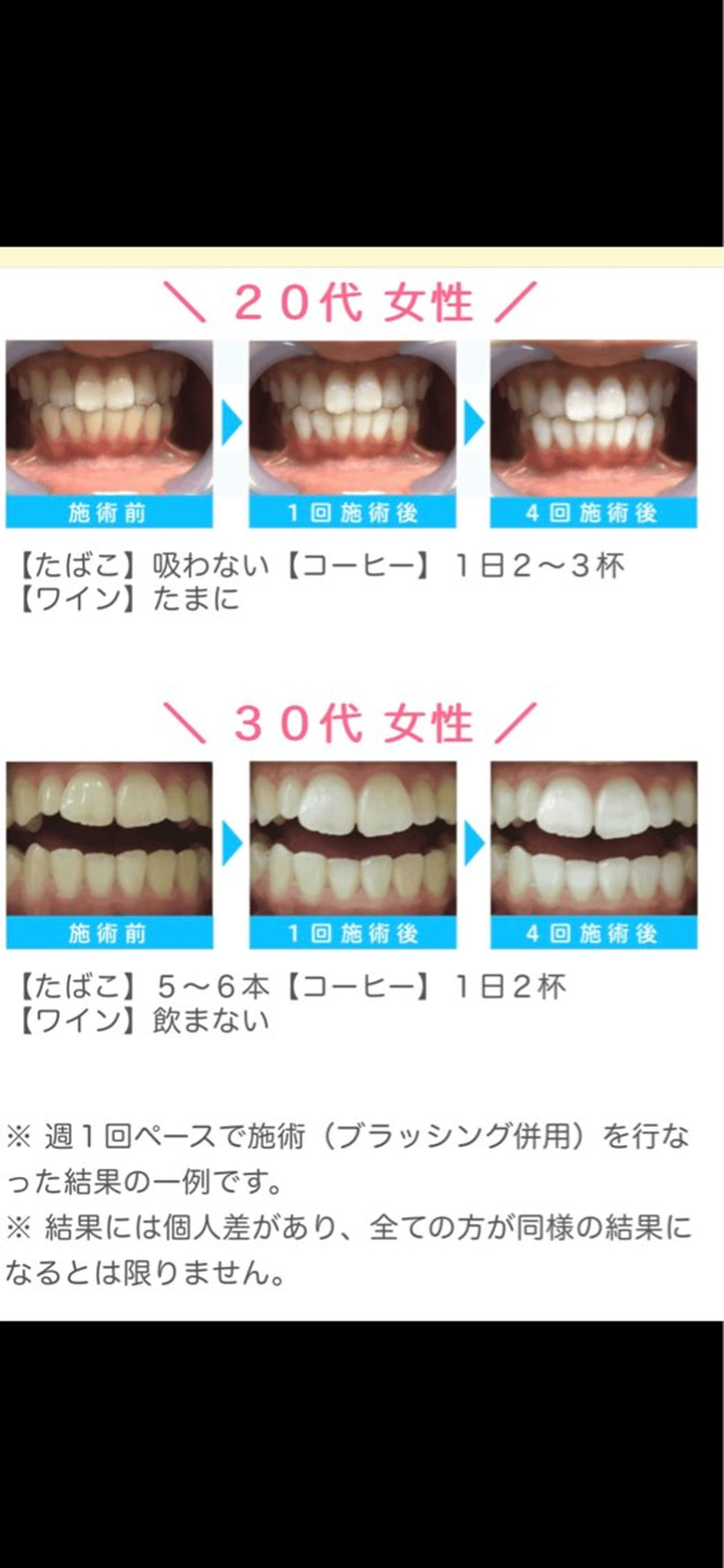 WHITENING ハウスのマツエク・マツパデザイン