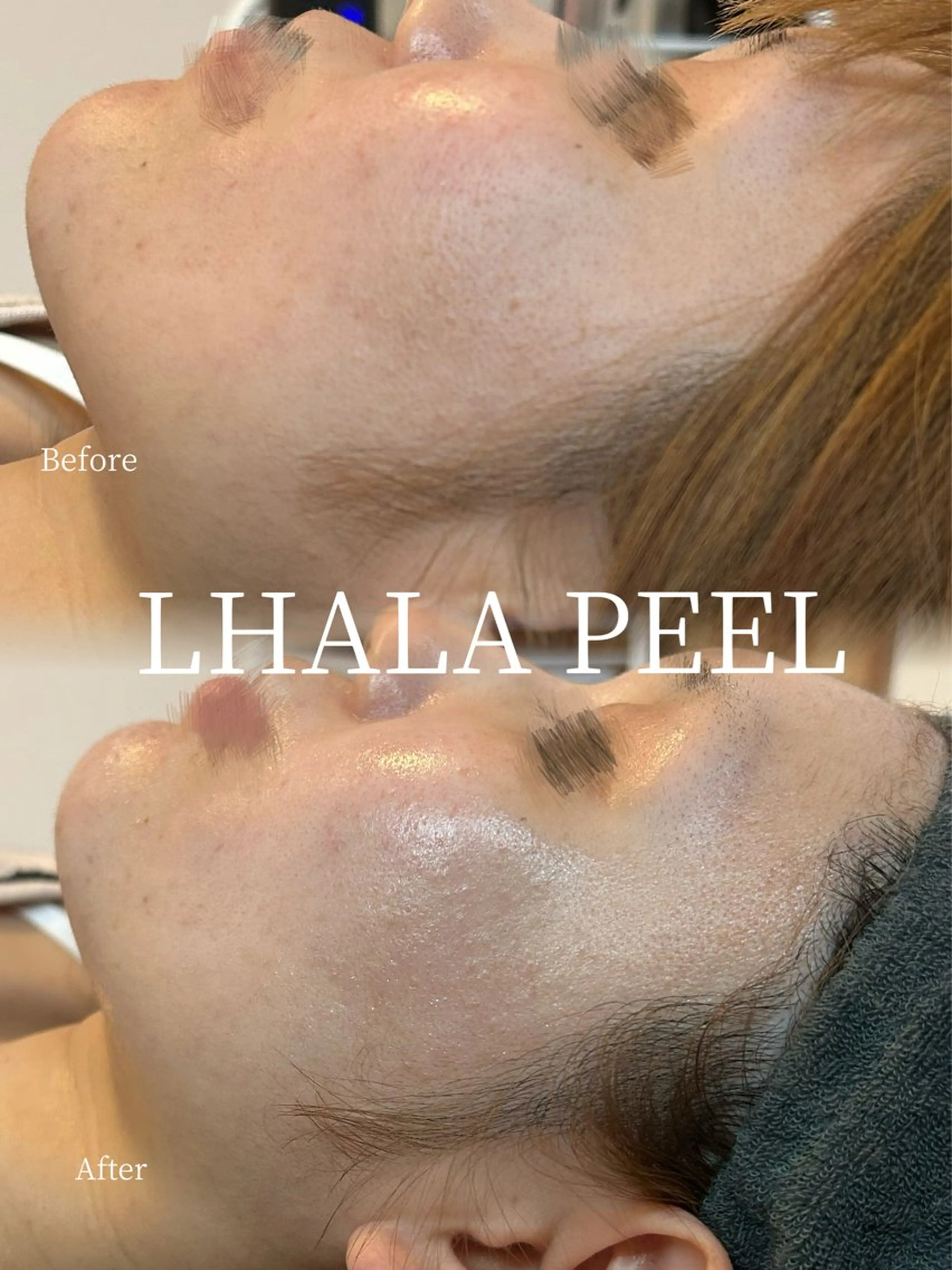 エステ Smoo アユミの眉毛・アイブロウイメージ