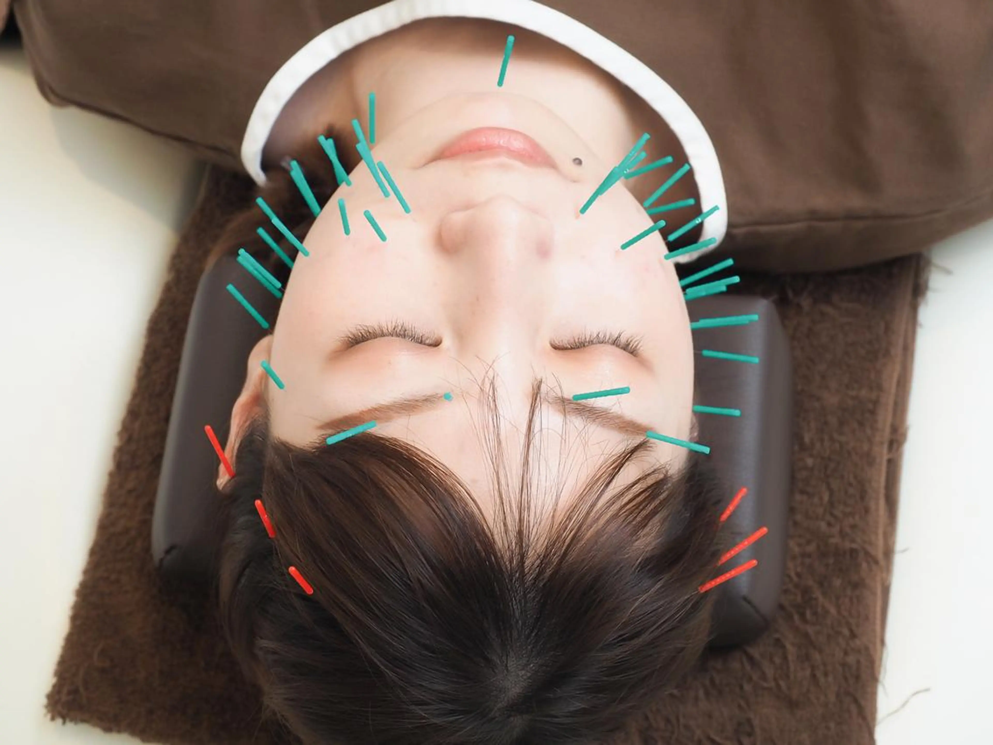 【最強リフトアップ🏅】サボテン美顔鍼➕ヘッドマッサージ🌵計70分の写真