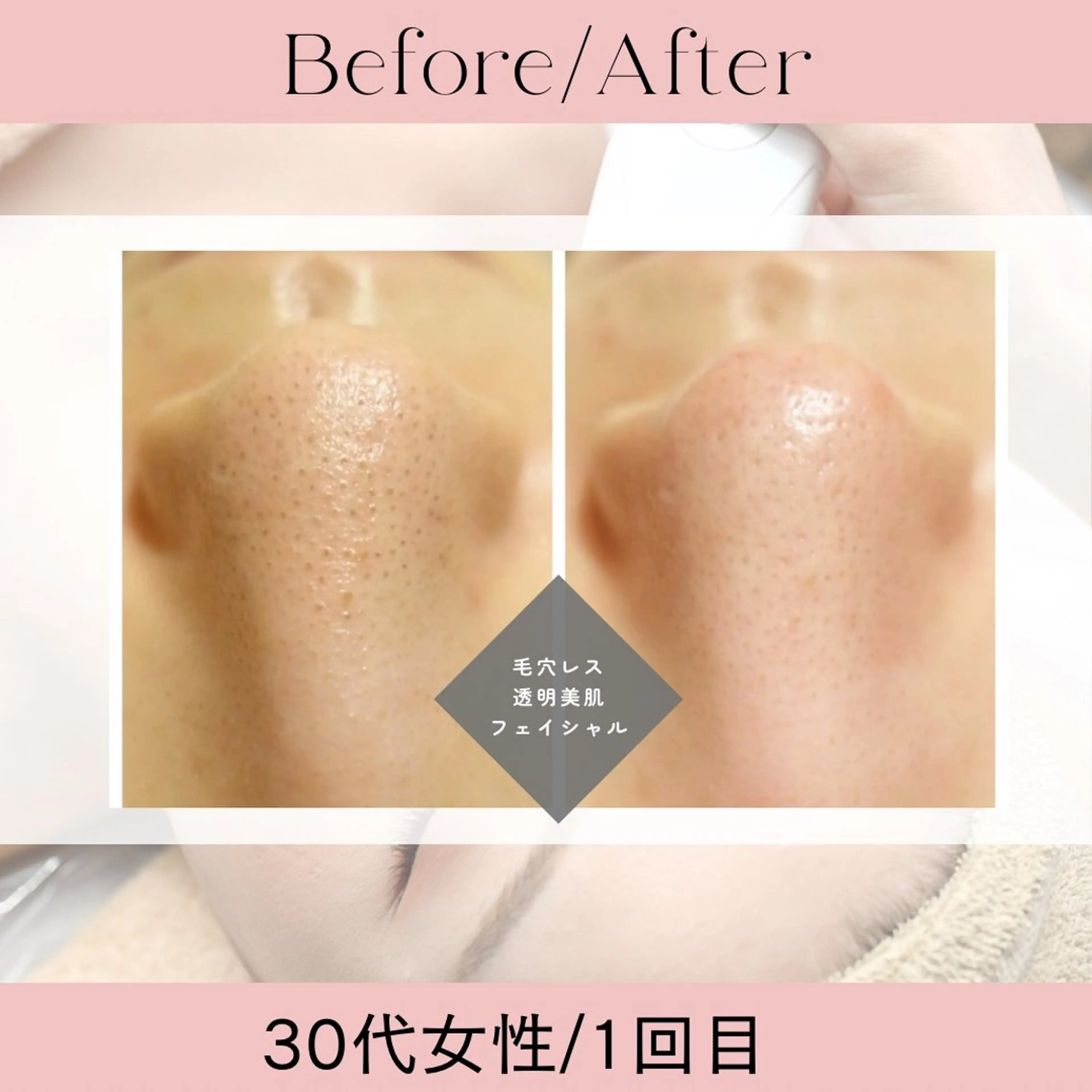 エステ 痩身&小顔サロン EXTREMITYのエステ・リラクイメージ