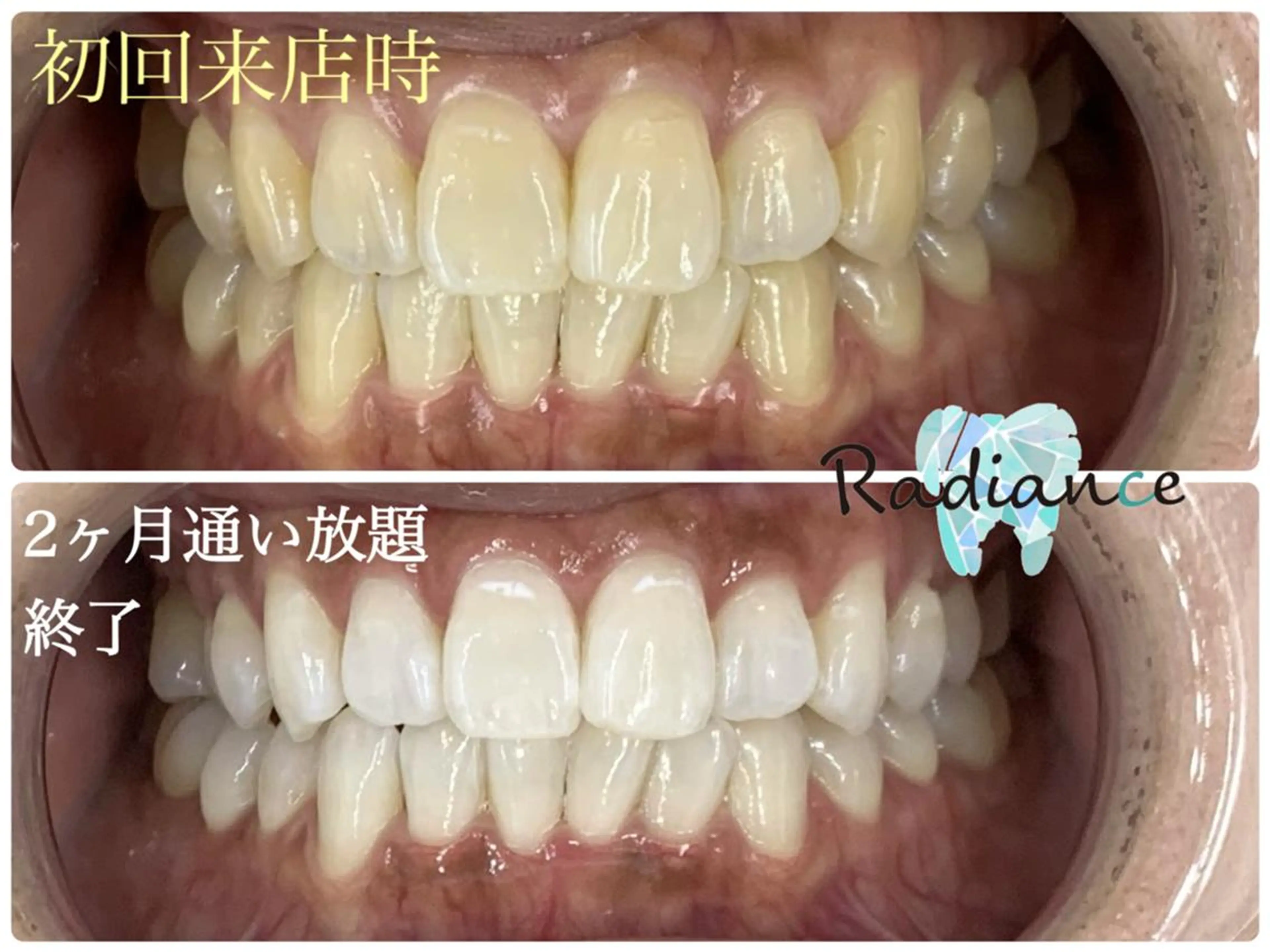 札幌ホワイトニング ラディアンス菊水店のその他イメージ