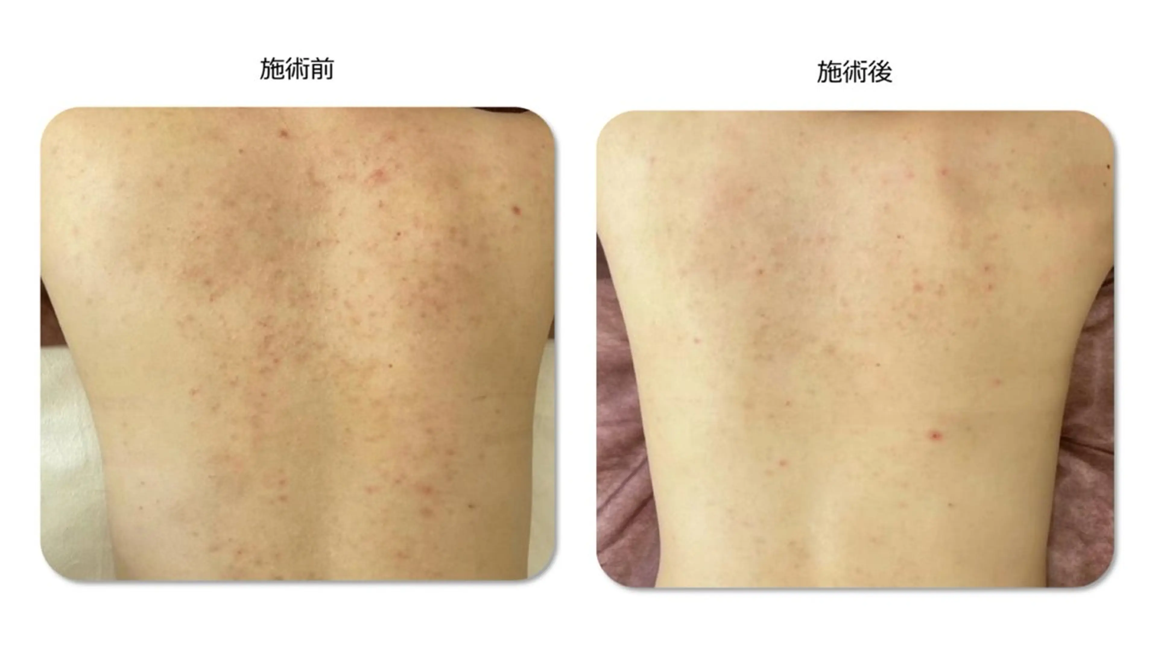 エステ 毛穴改善サロン d'Alba大阪住吉のエステ・リラクイメージ