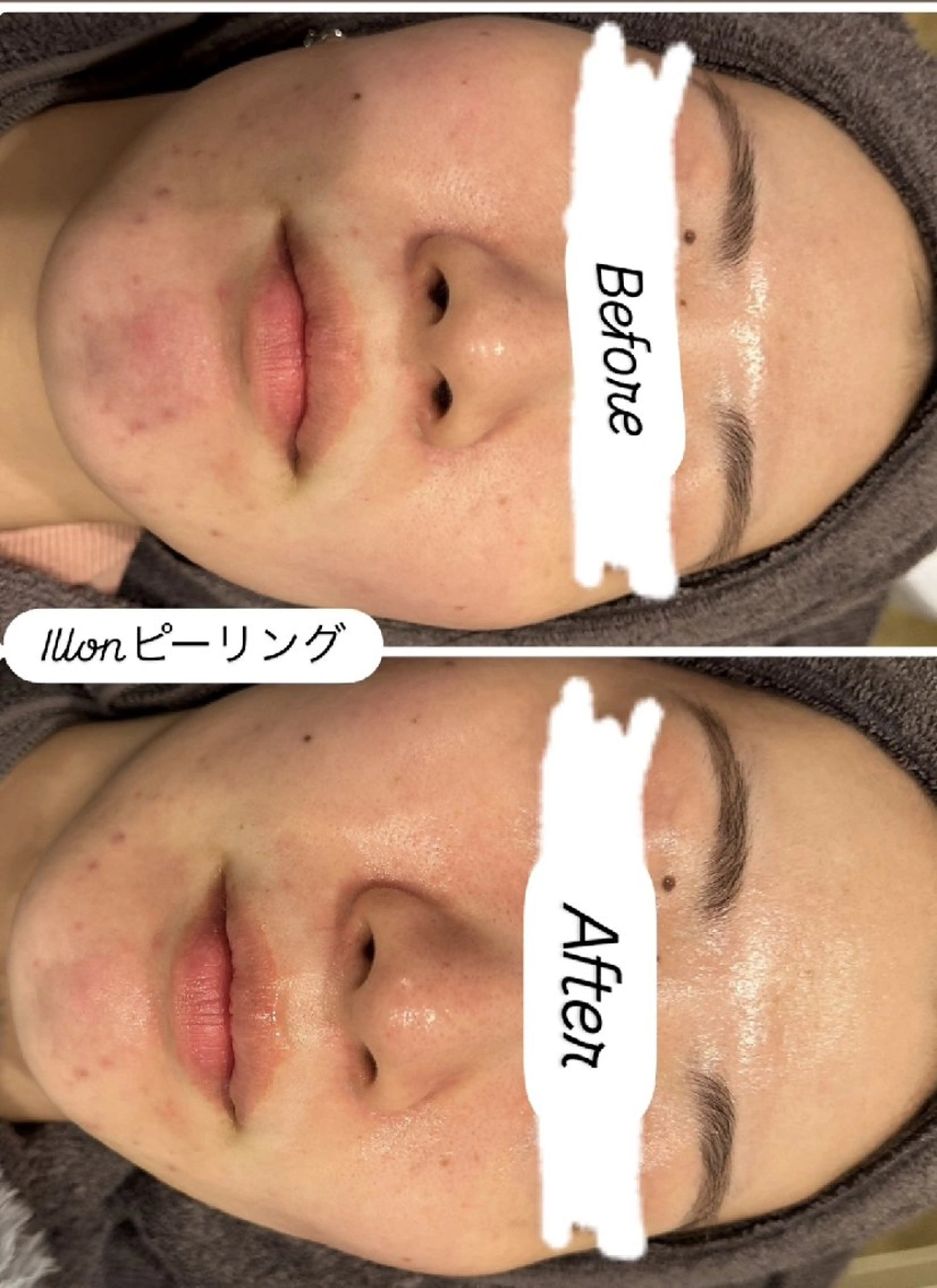 エステ 看護師 桐山 まどかのその他イメージ