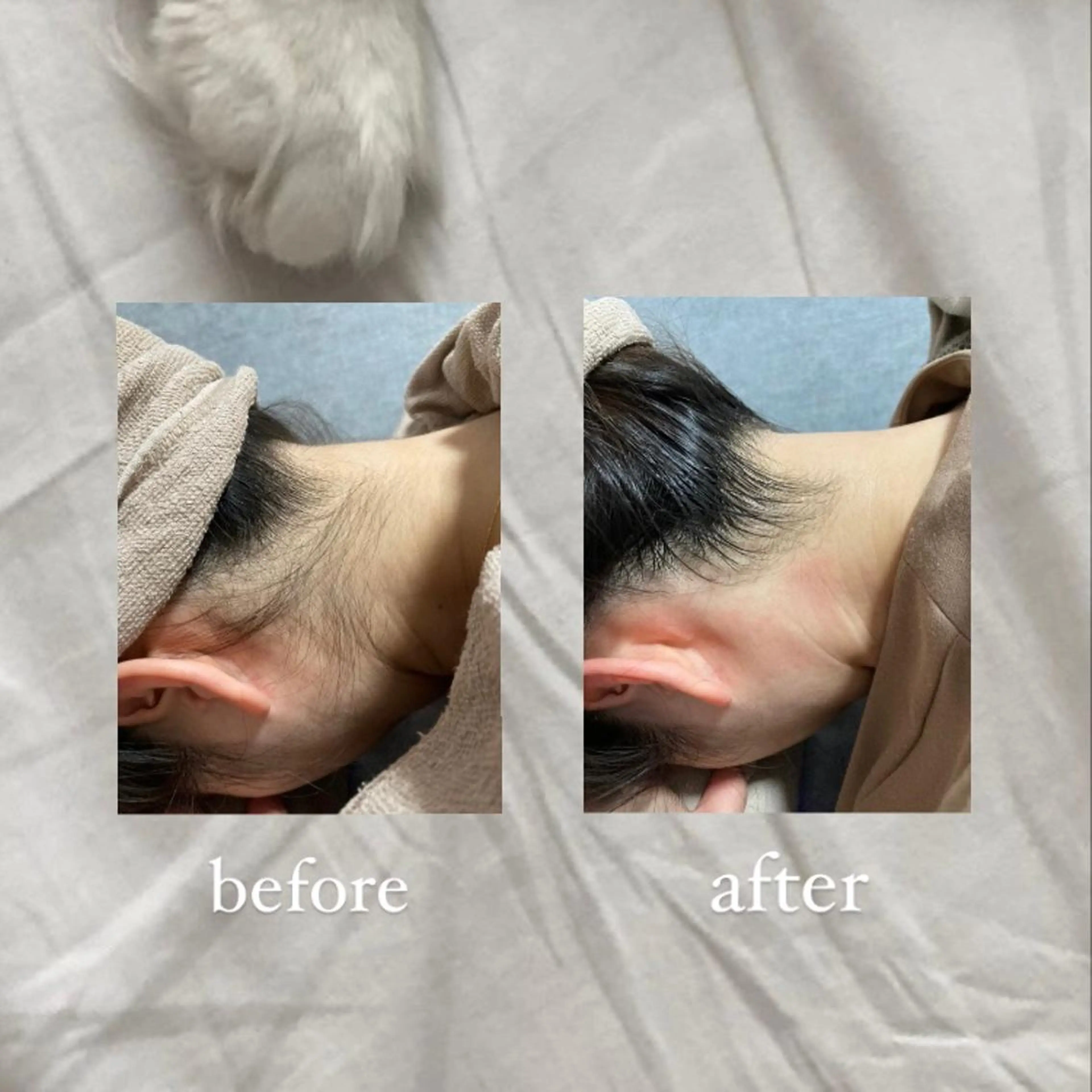 脱毛 crescent所属・【韓国肌管理・脱毛】 クレセントのその他イメージ