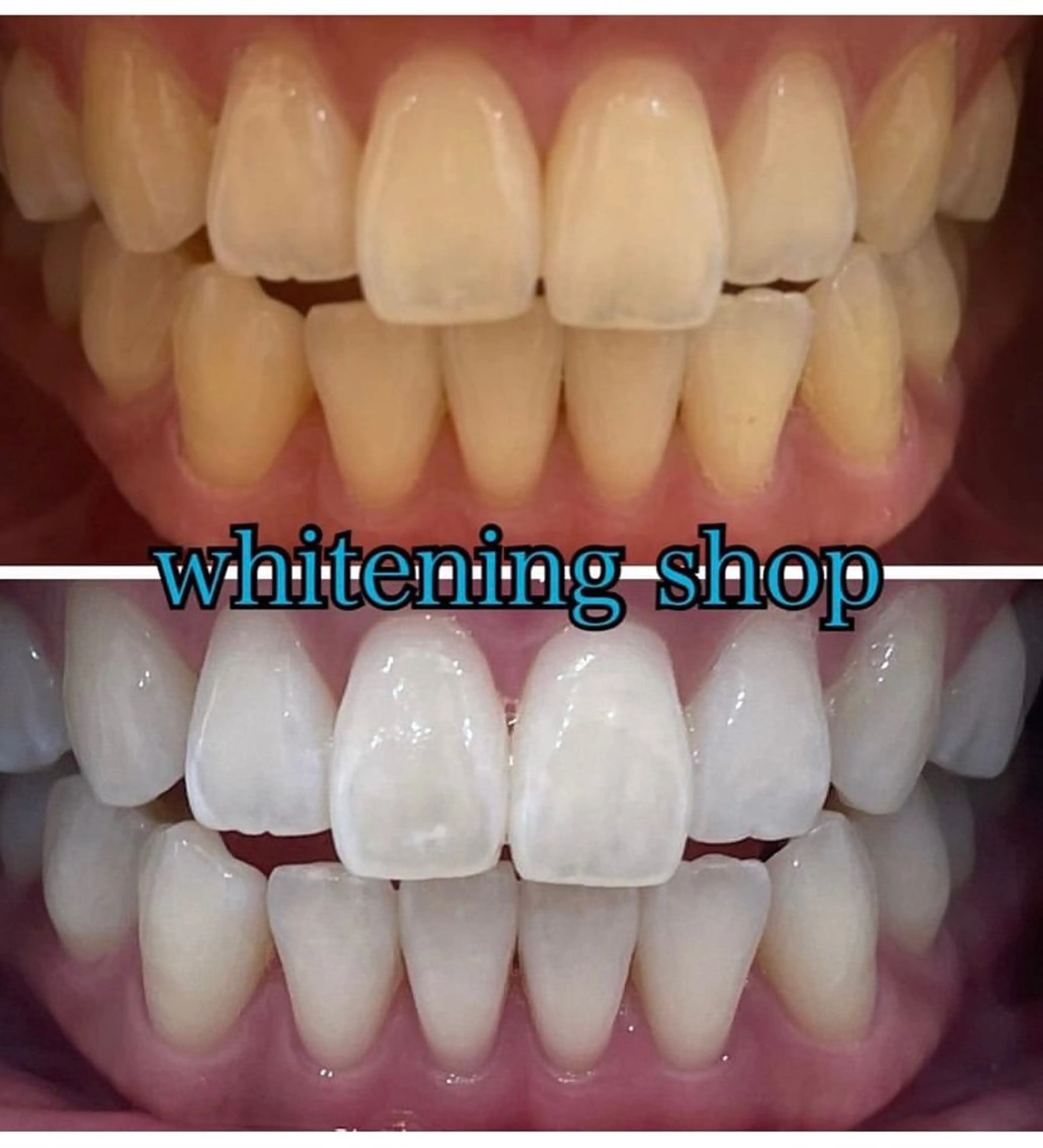 エステ リラク ホワイトニング ショップ吉祥寺店のエステ・リラクイメージ