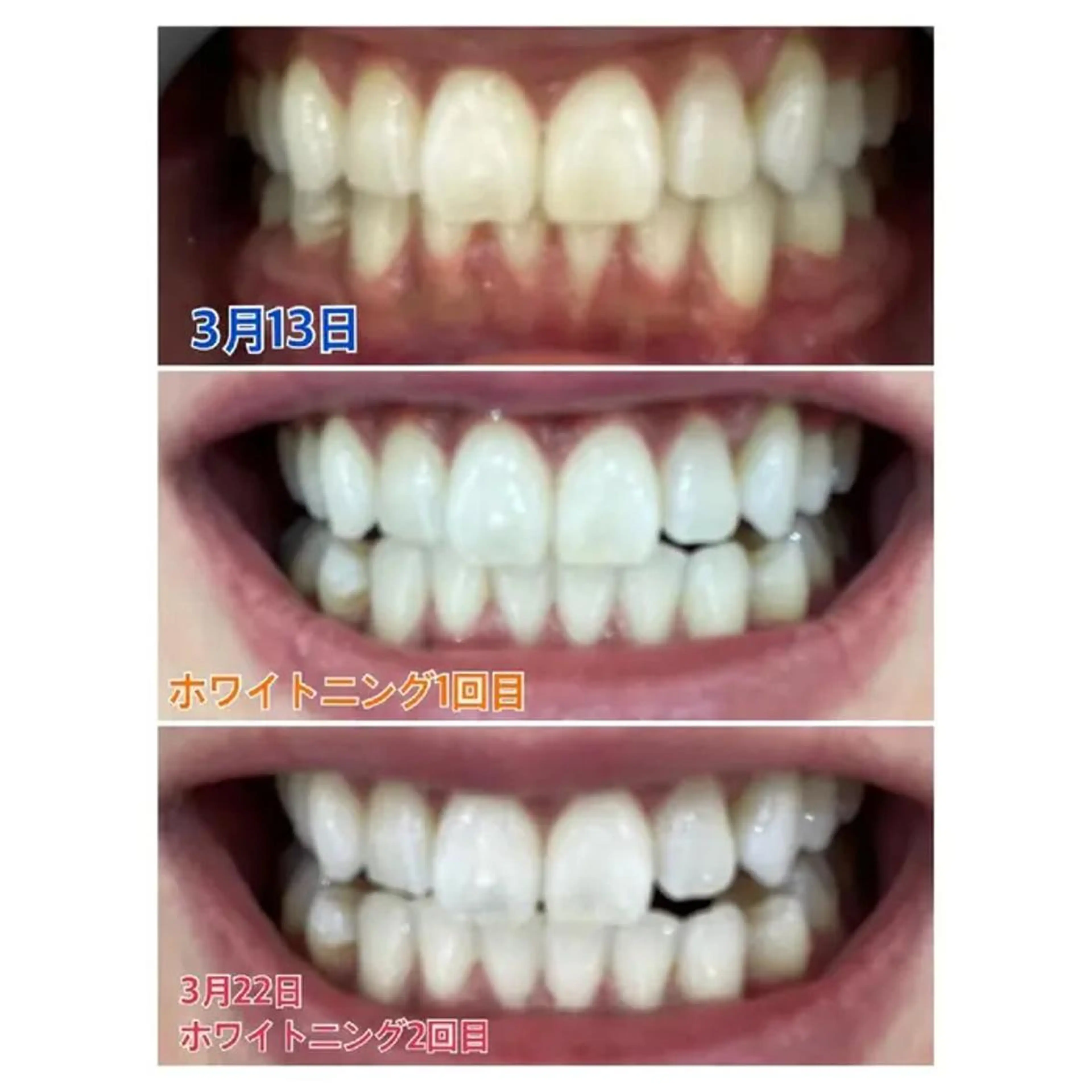 Ｍ渋谷 ホワイトニングのエステ・リラクイメージ