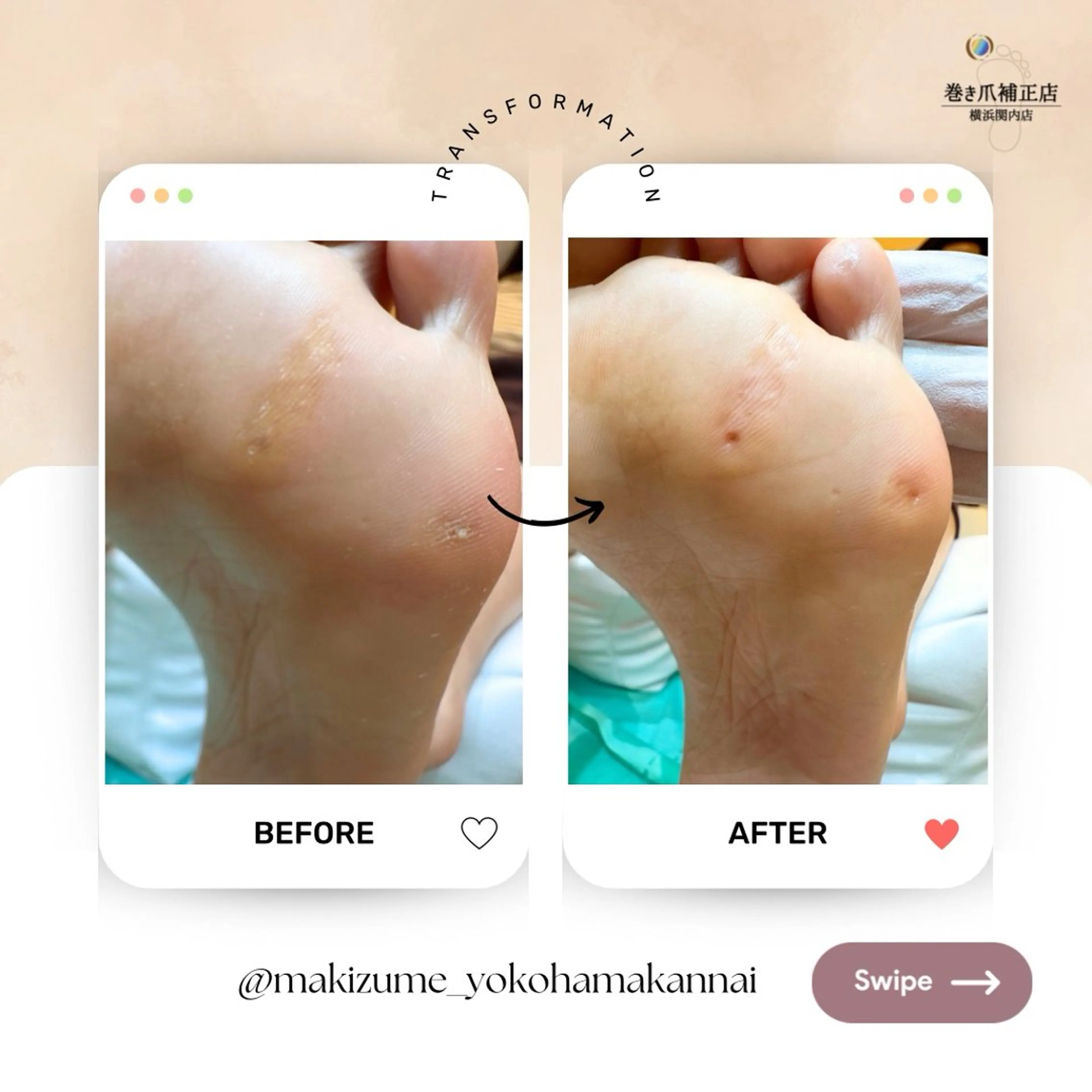 ネイル フットネイル 巻き爪補正店 横浜関内店のネイルデザイン