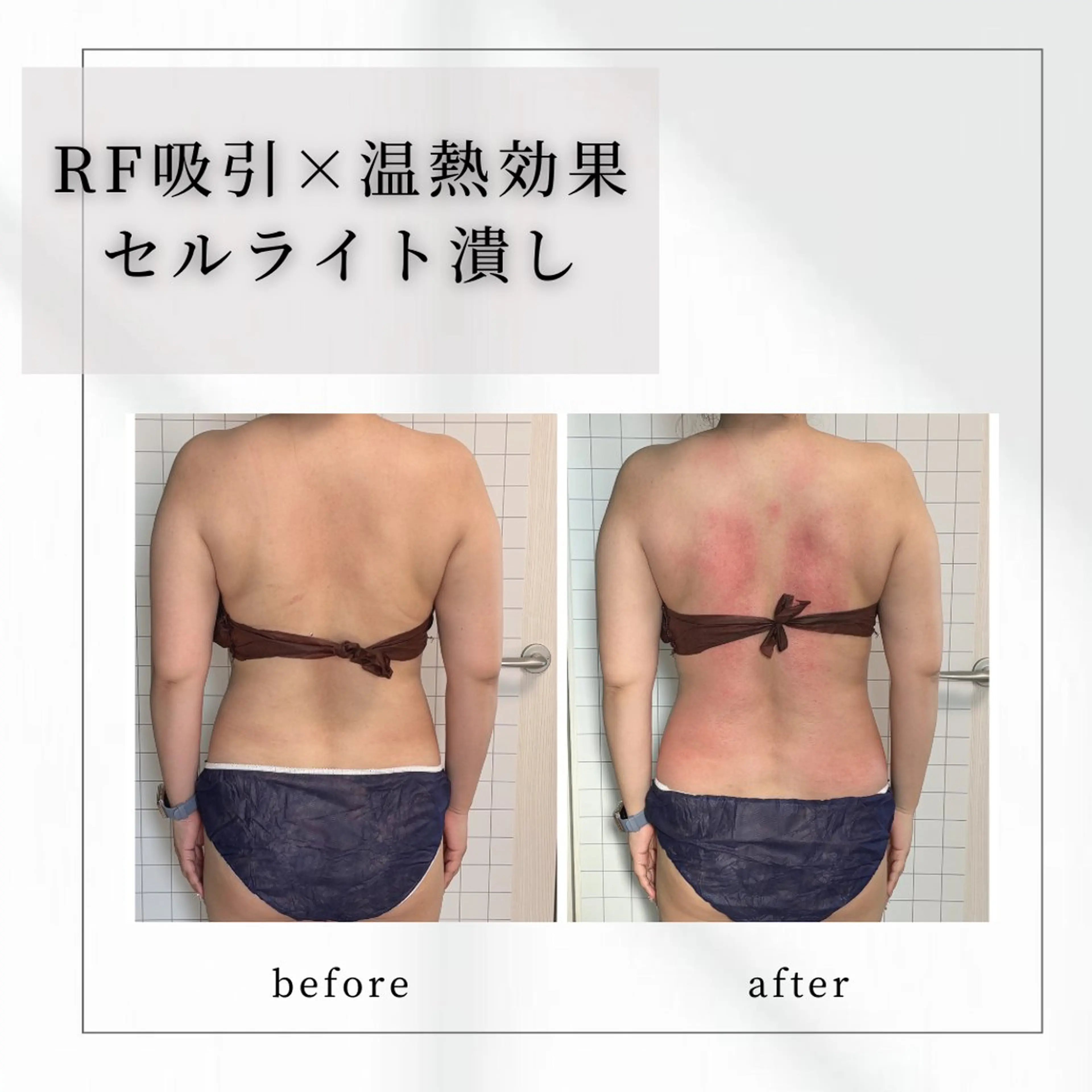 小顔矯正専門店 【RED】池田のエステ・リラクイメージ