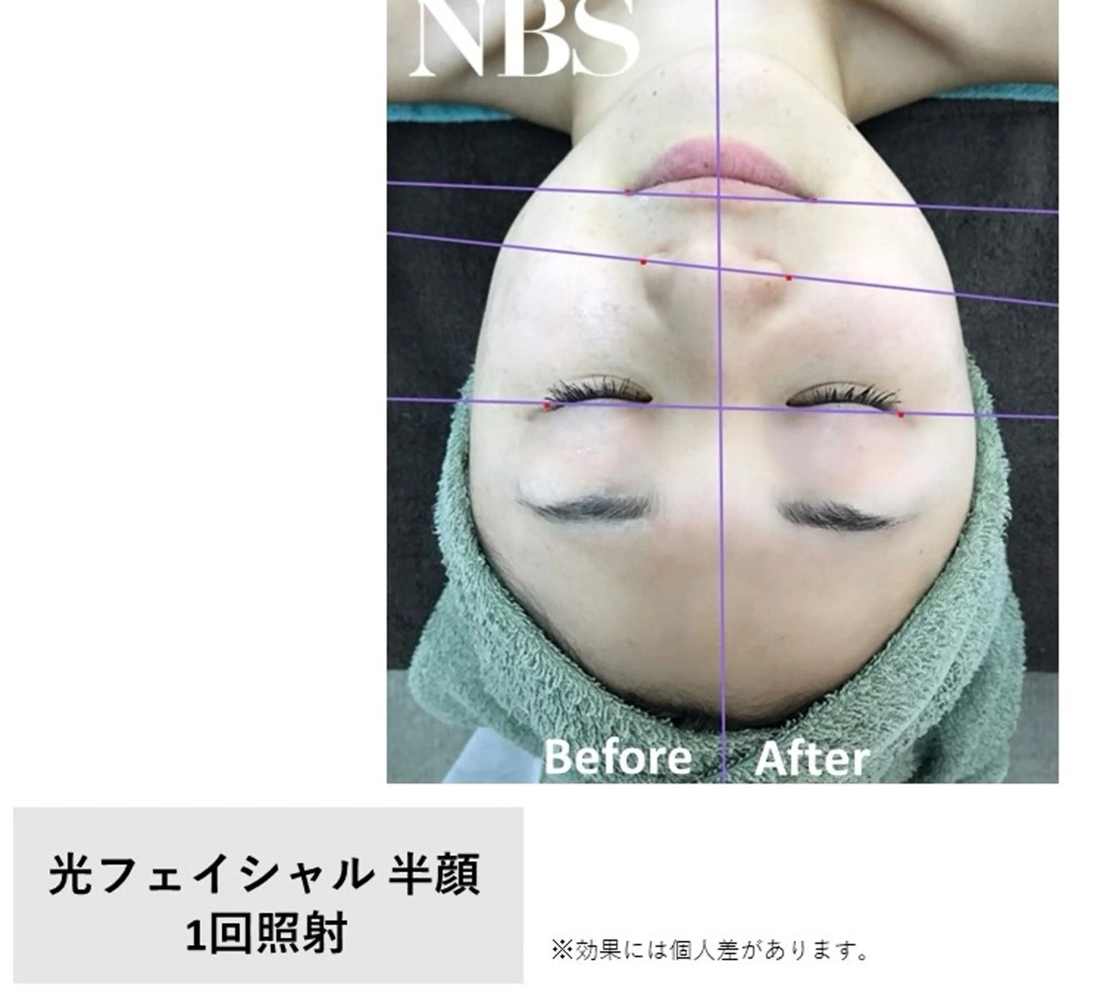 エステ E'clat Kanaのエステ・リラクイメージ