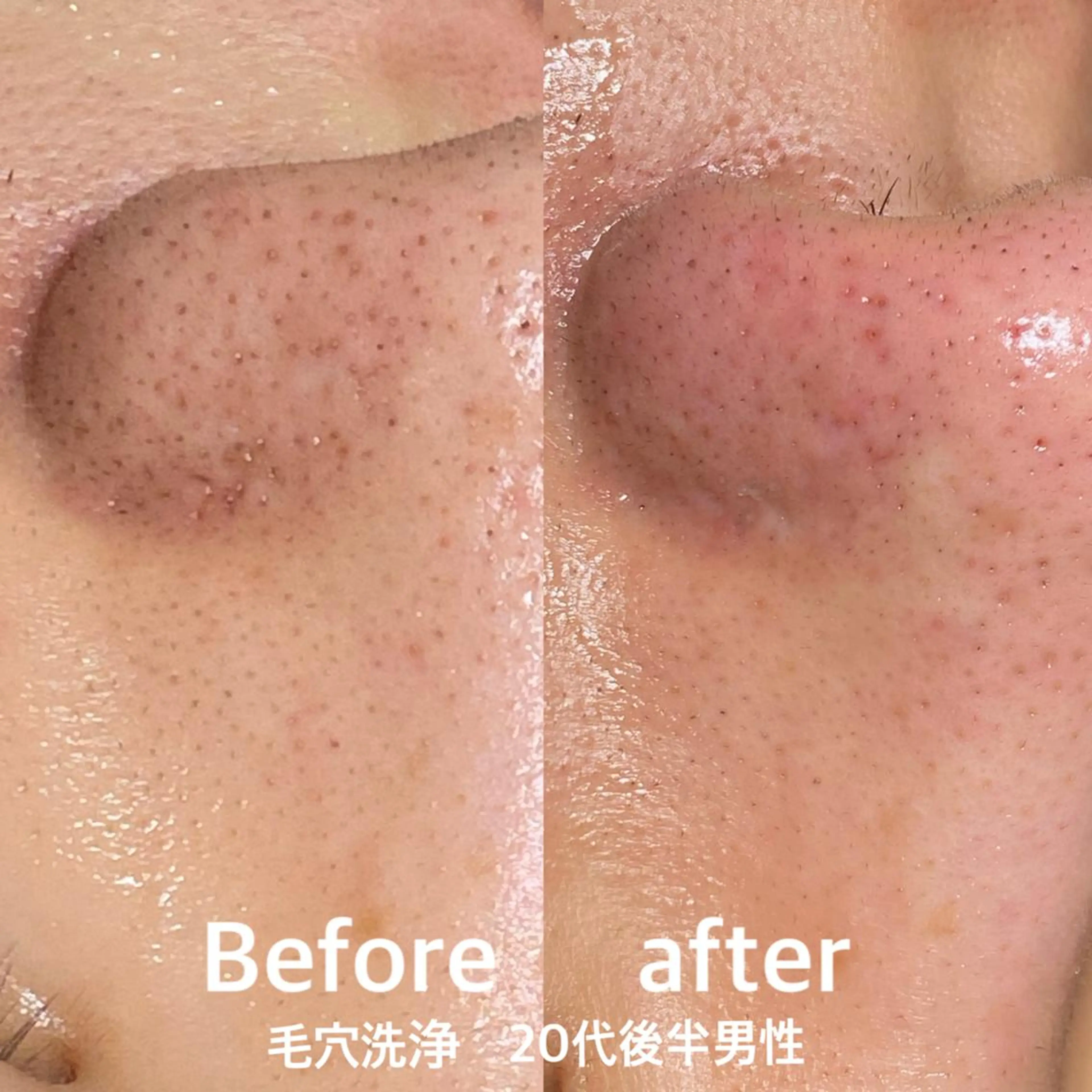 村松/ 小顔,ボディケアのエステ・リラクイメージ