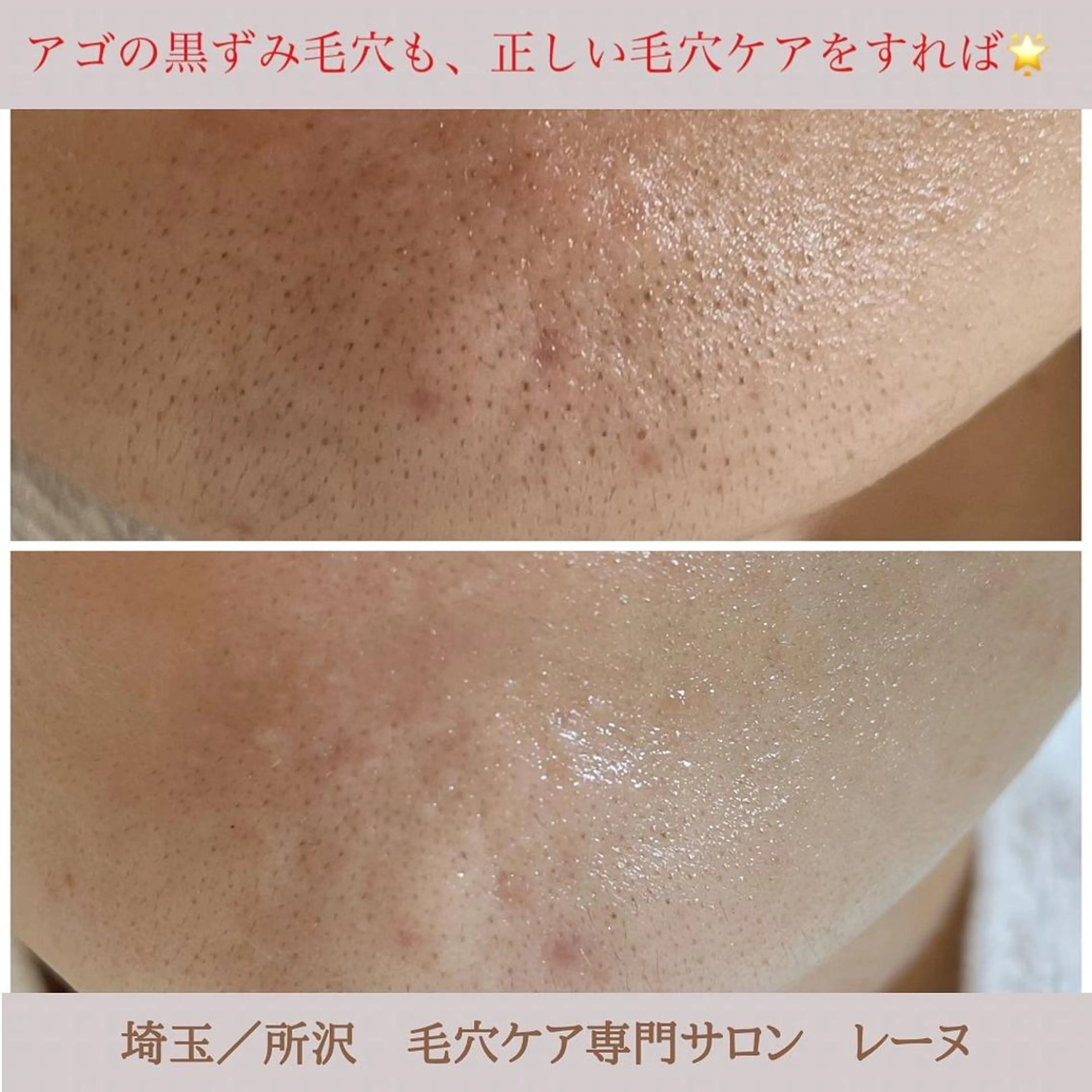 毛穴ケア専門サロン レーヌのエステ・リラクイメージ