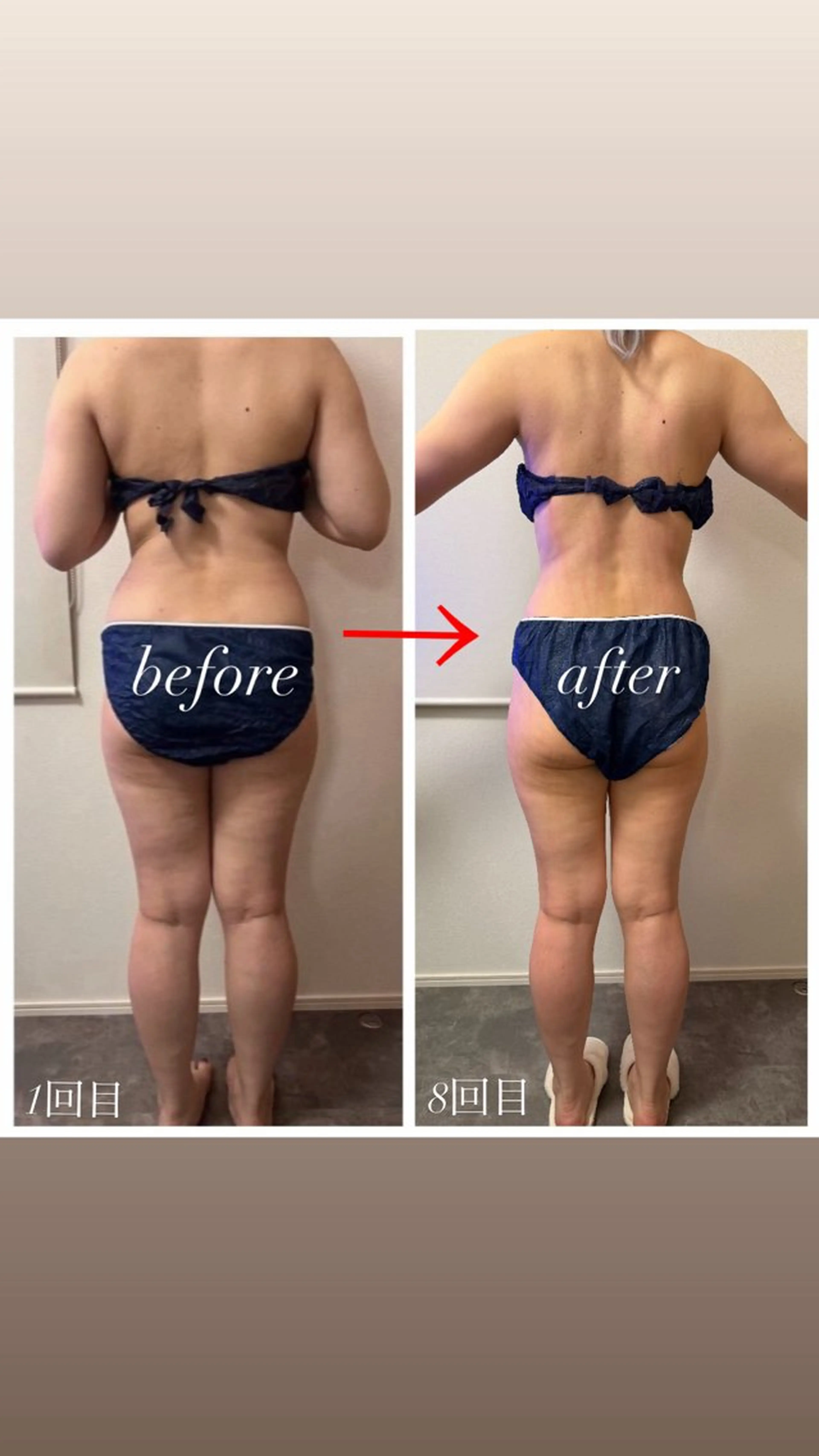 A.所属・Raviy(A.) 【痩身・韓国肌管理】のエステ・リラクイメージ