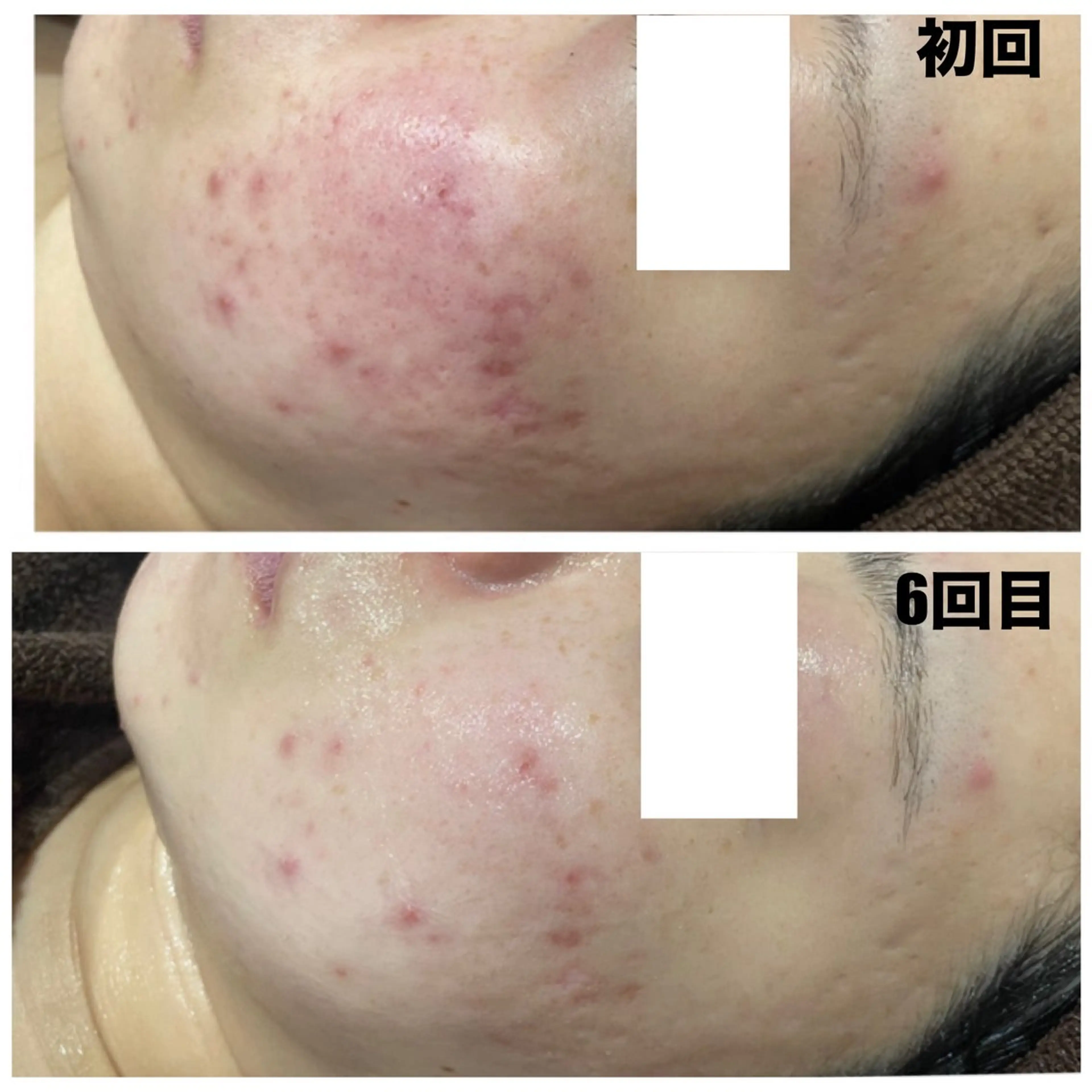 Linoa（リノア） エステ&リラクのエステ・リラクイメージ