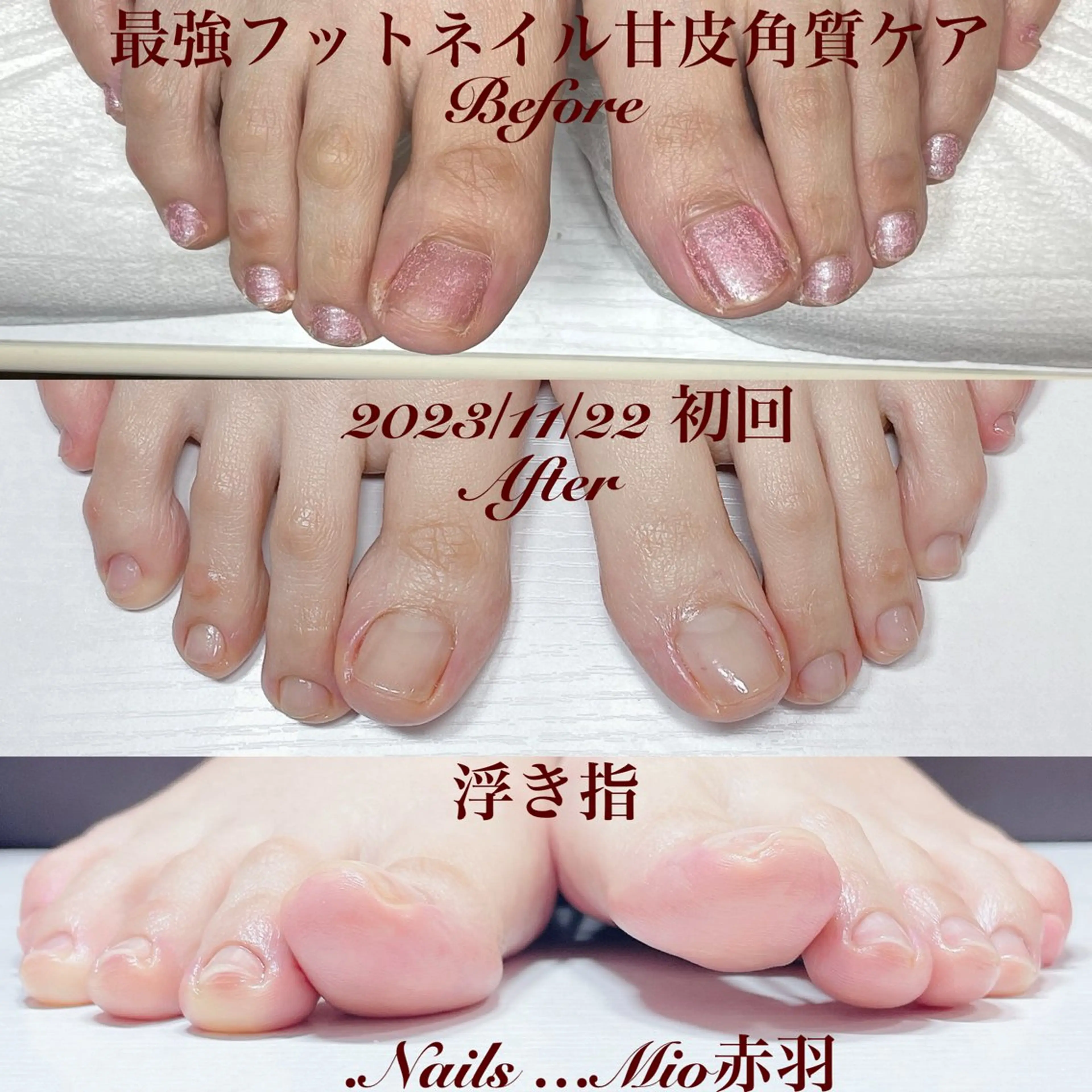ネイル フットネイル .Nails Mio 赤羽西ネイルサロンのネイルデザイン