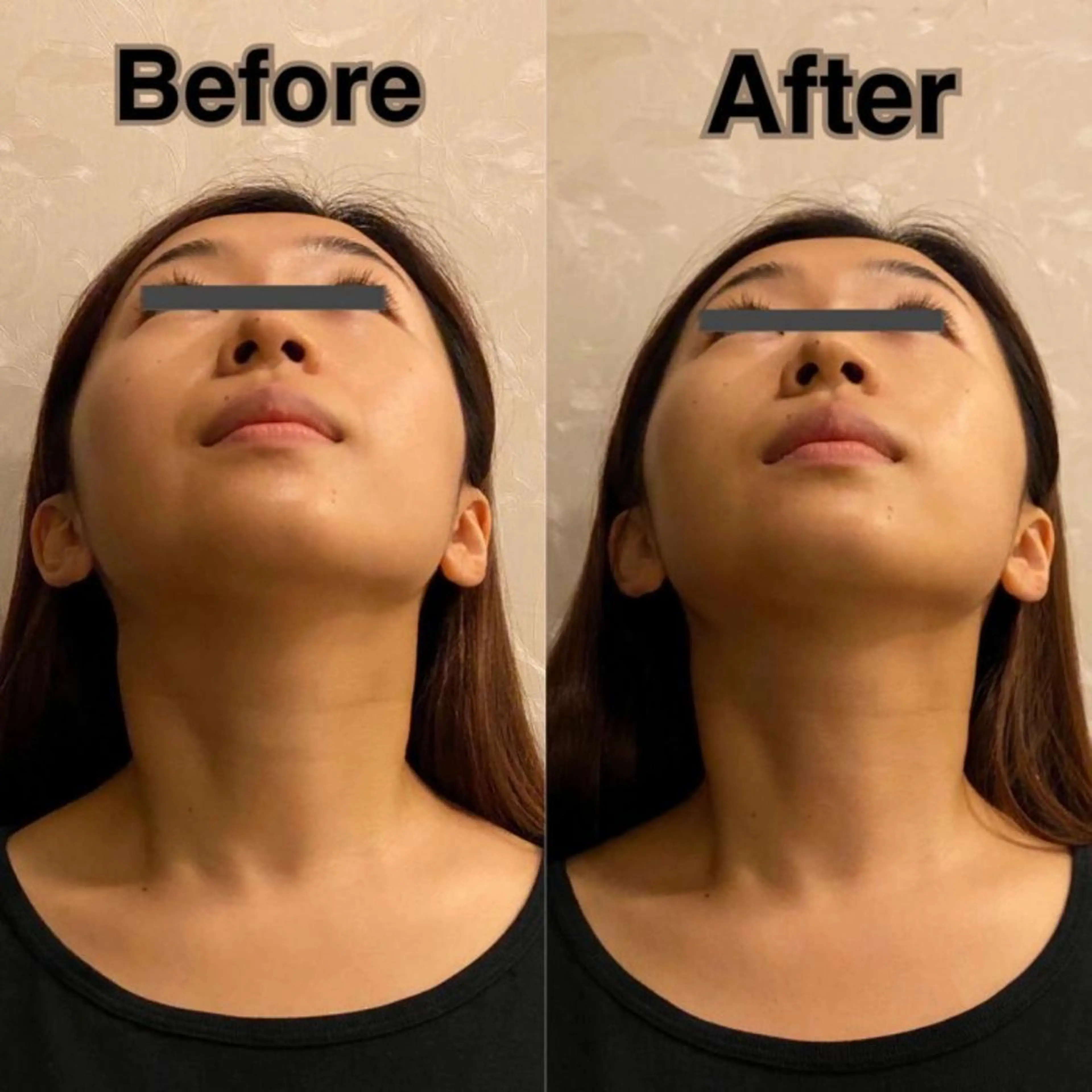 姿勢・骨盤/小顔矯正 痩身ダイエット 横田のエステ・リラクイメージ