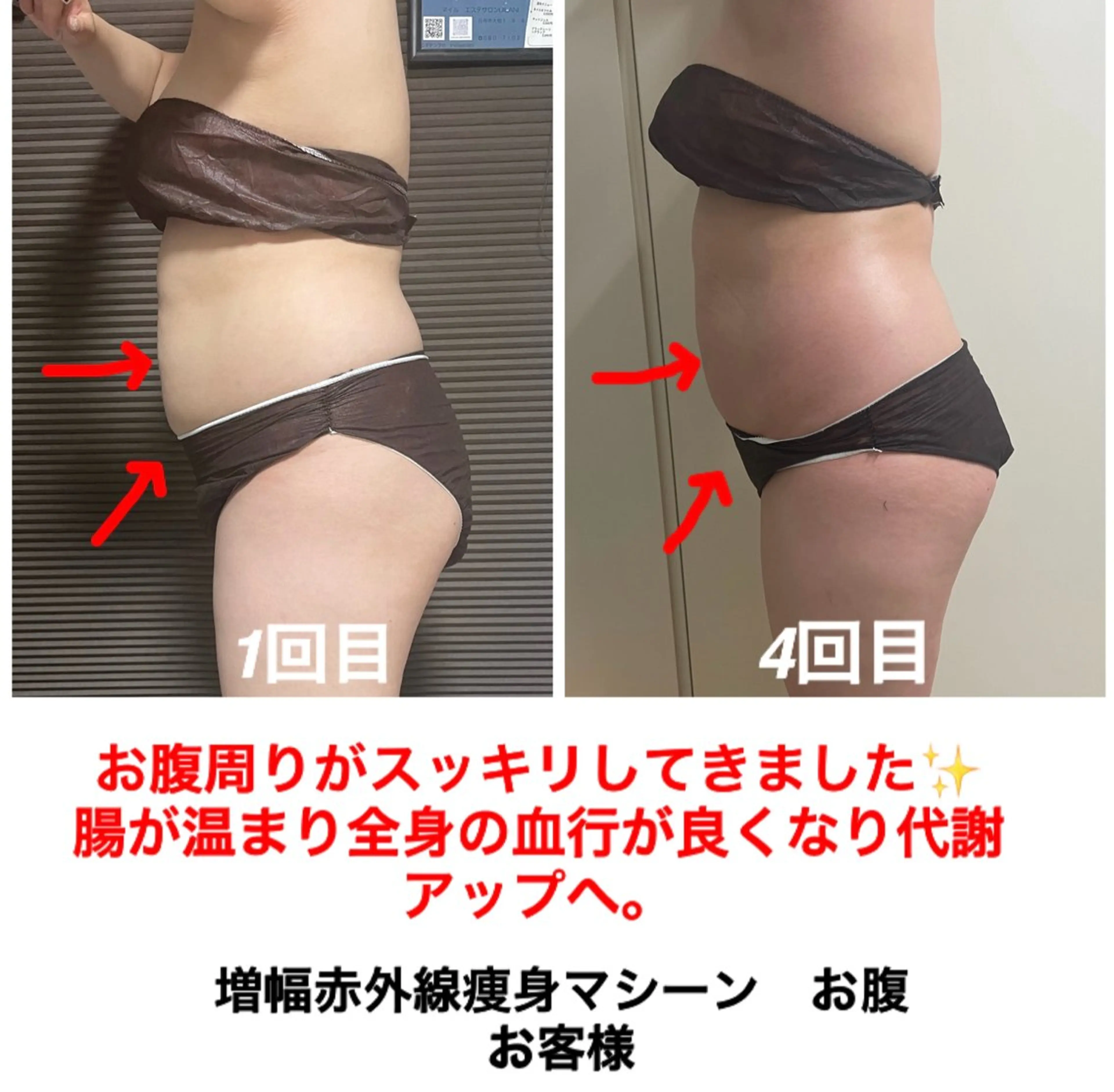 エステ ネイル・エステサロンUILANI所属・ネイル・エステサロン UILANIのネイルデザイン