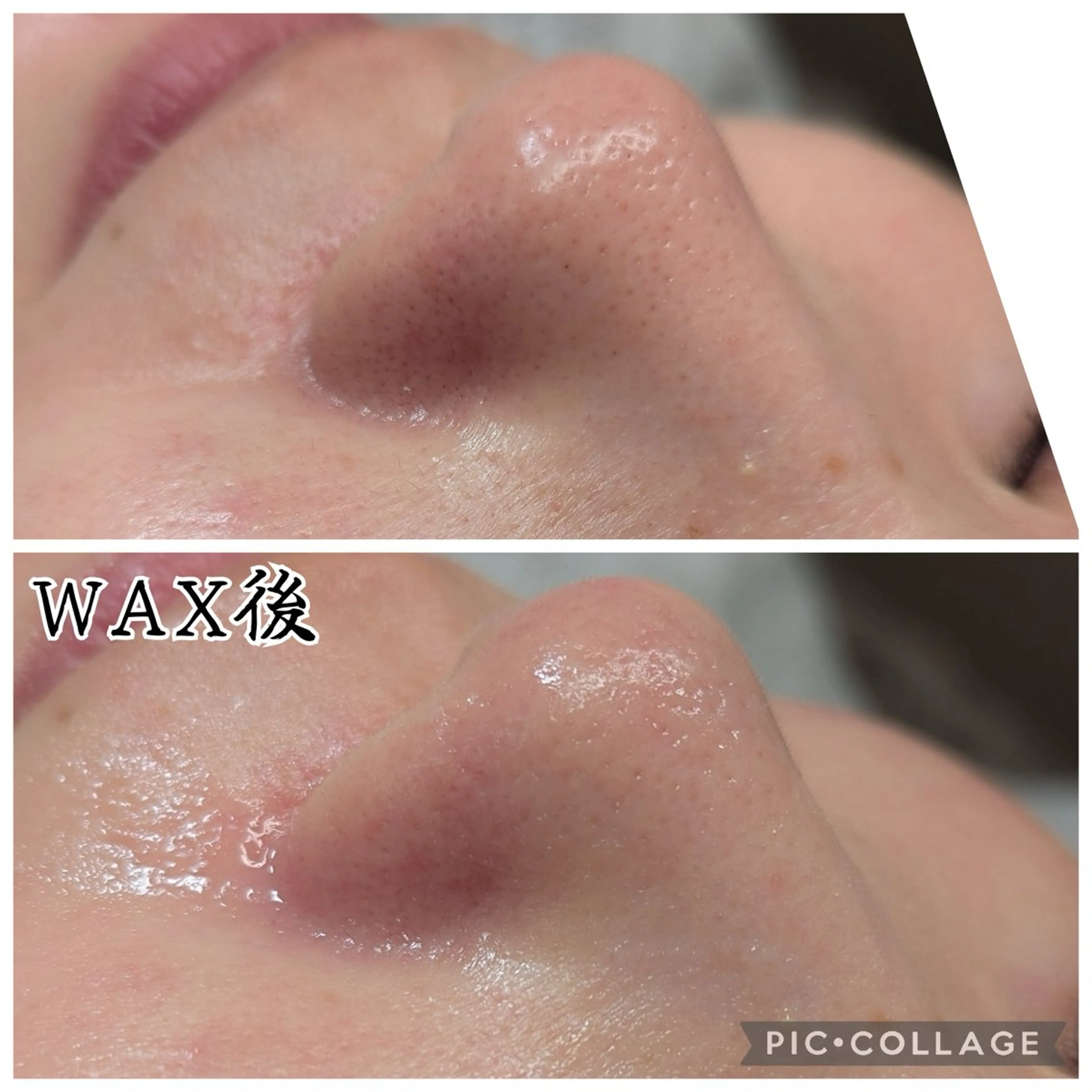 脱毛 肌質改善サロン with Uのエステ・リラクイメージ