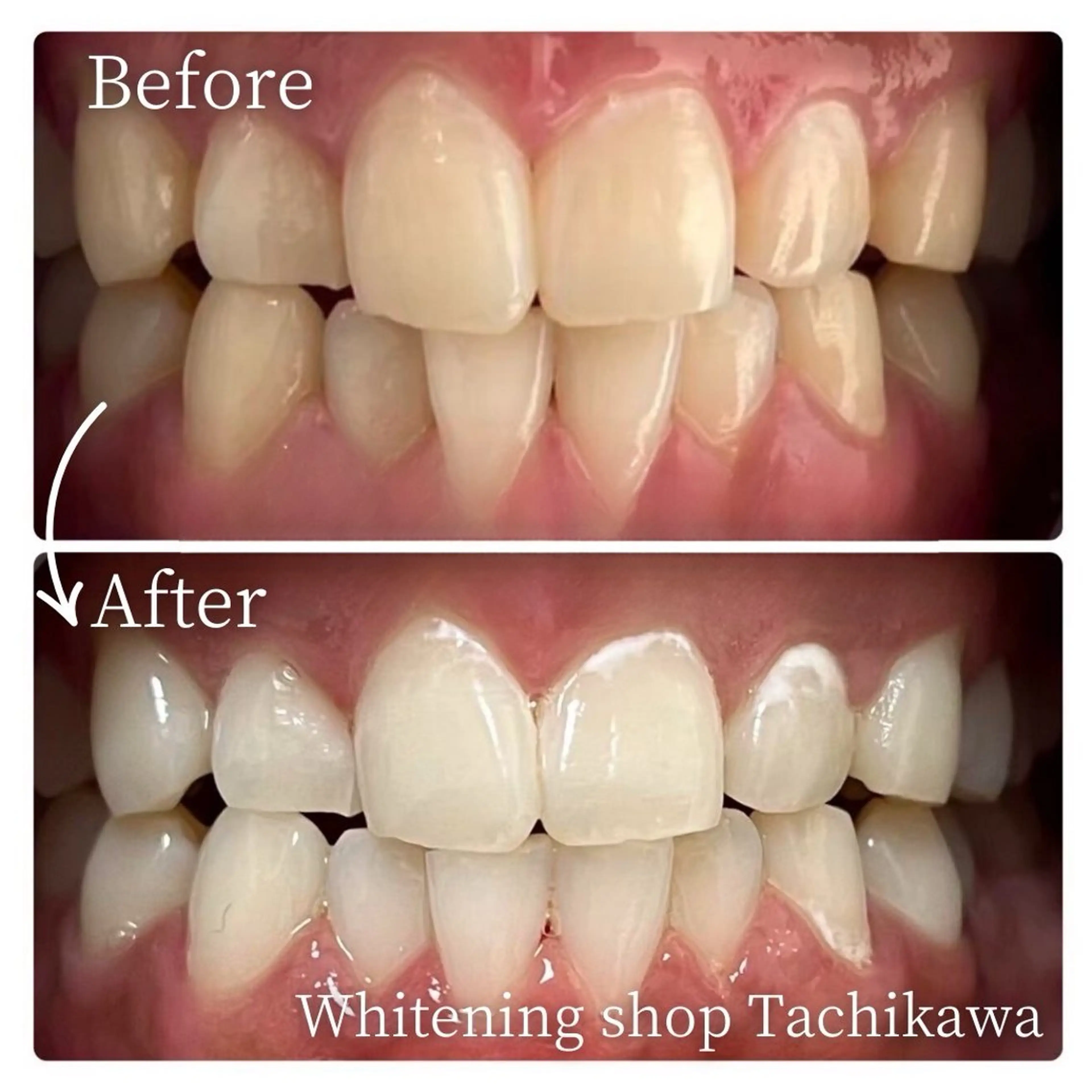 セルフ　ホワイト ニングショップ立川のその他イメージ