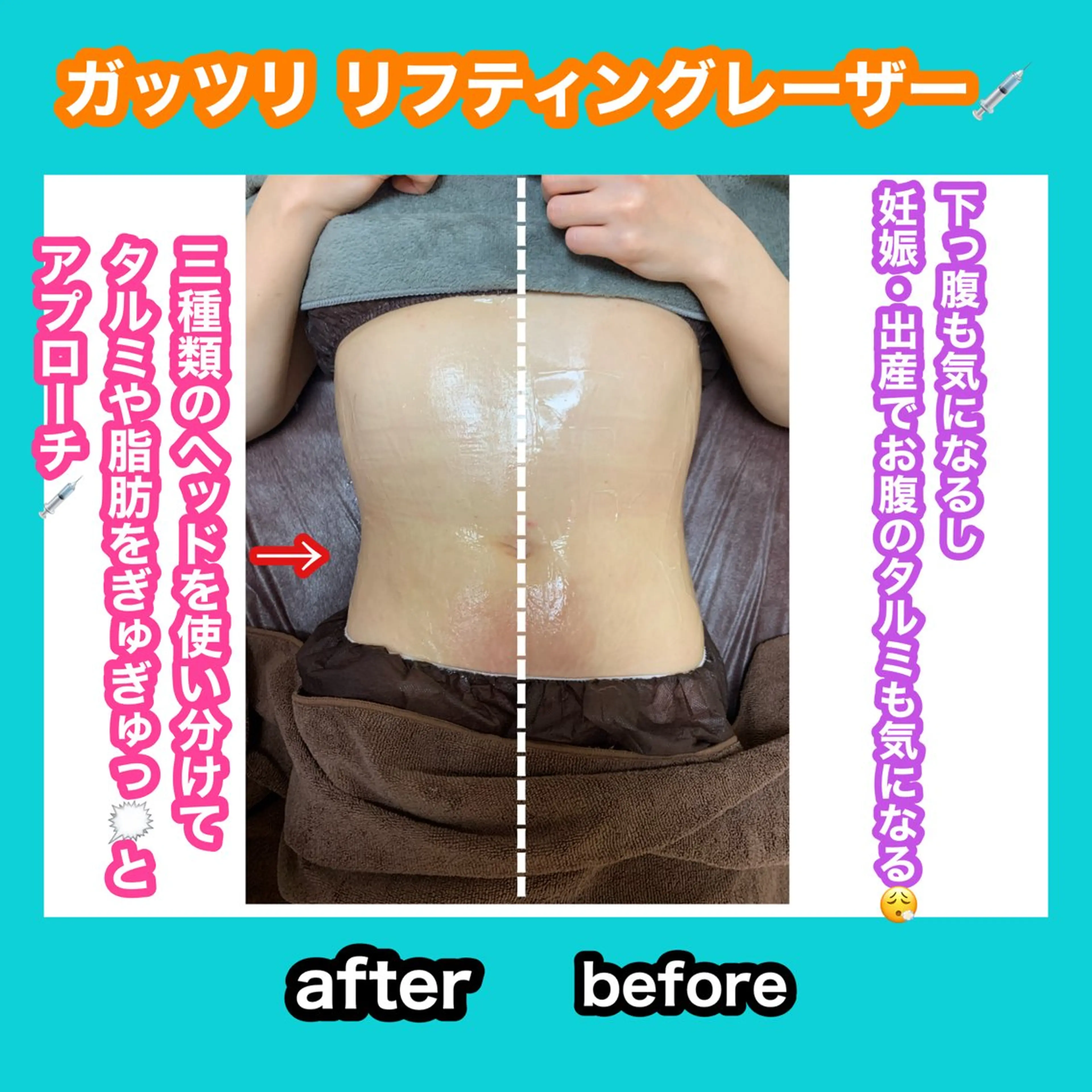 エステ 痩身/脱毛/ネイル HARUKAのエステ・リラクイメージ