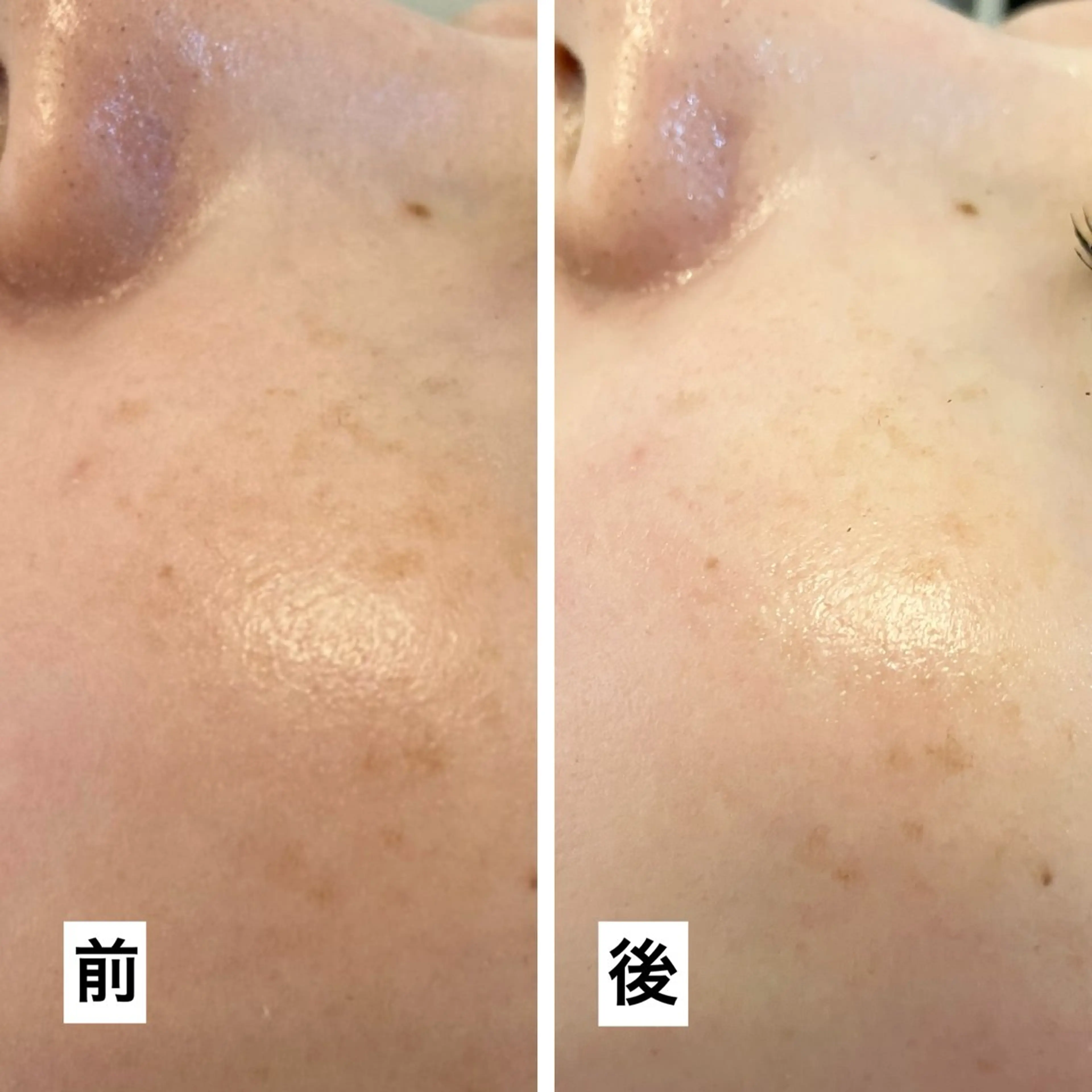 たるみ改善小顔エステ 堀葉月のその他イメージ