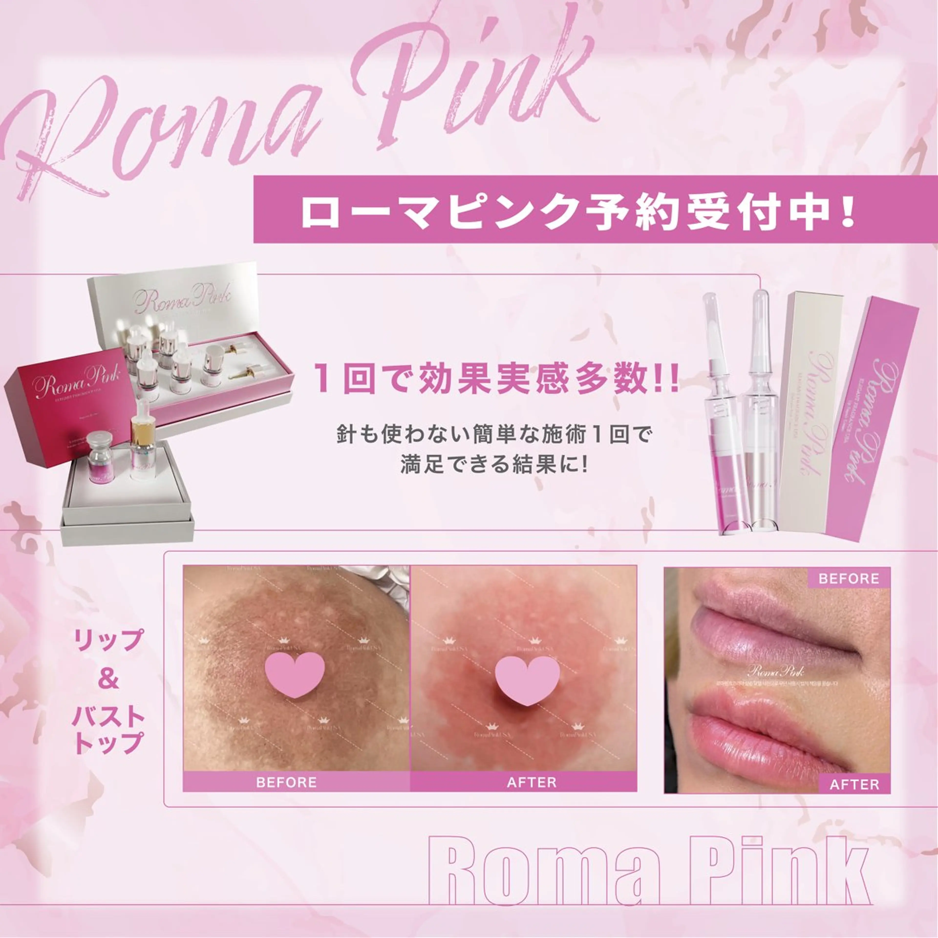 小顔・肌悩み専門店 ボーテドリッシュのエステ・リラクイメージ