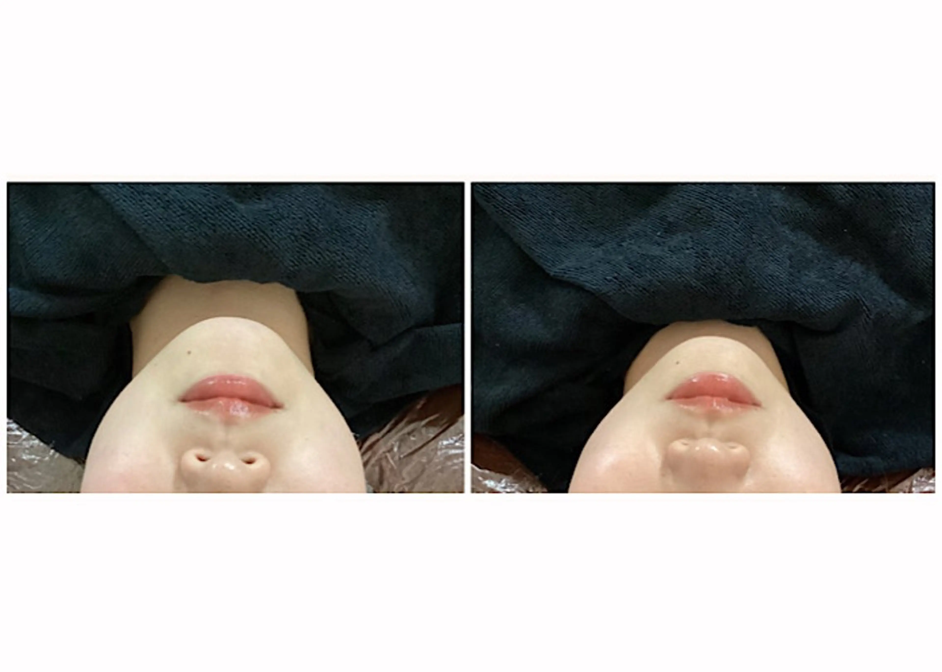 ize 横浜店のエステ・リラクイメージ