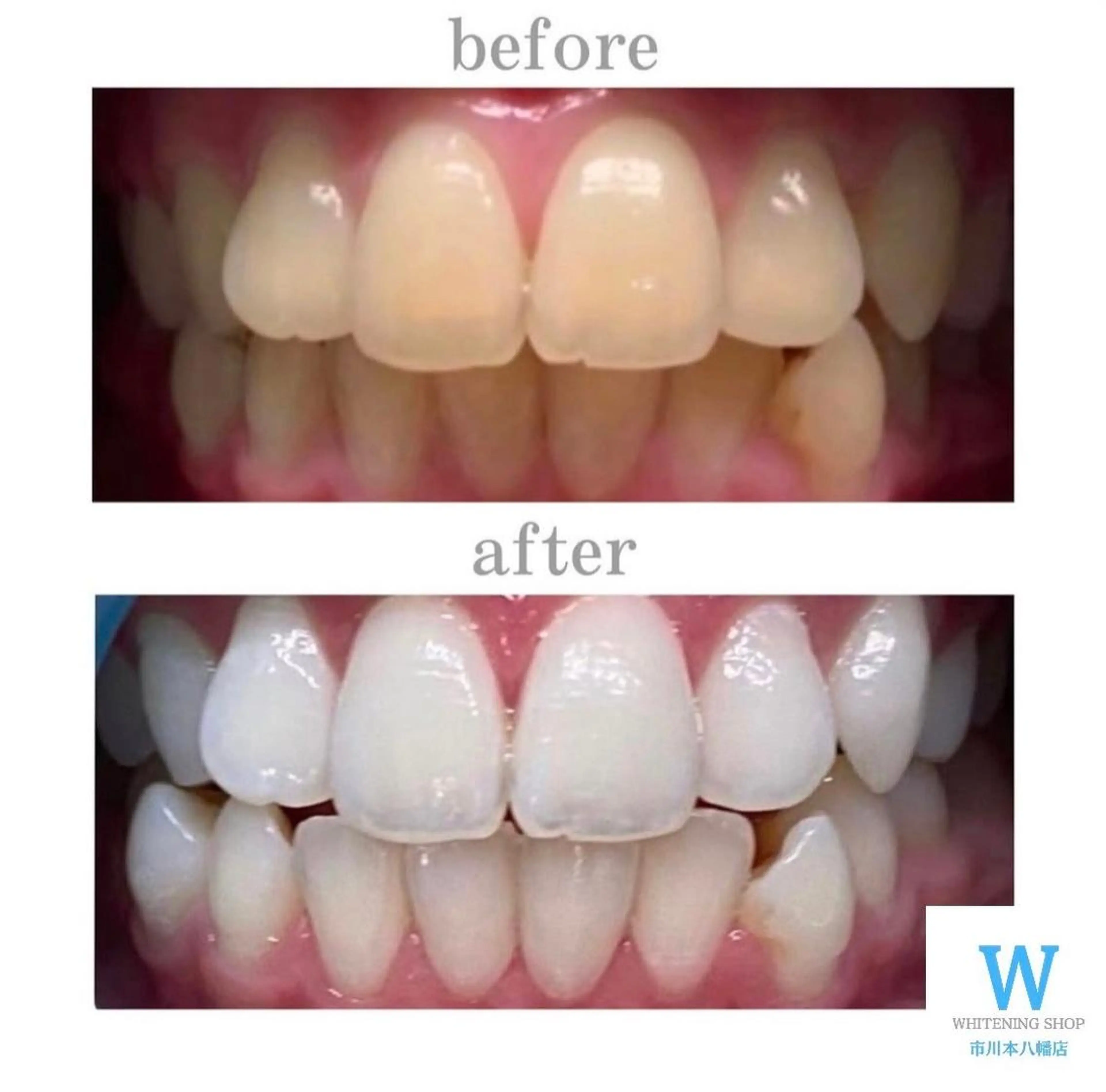 エステ リラク ホワイトニング ショップ本八幡店のエステ・リラクイメージ